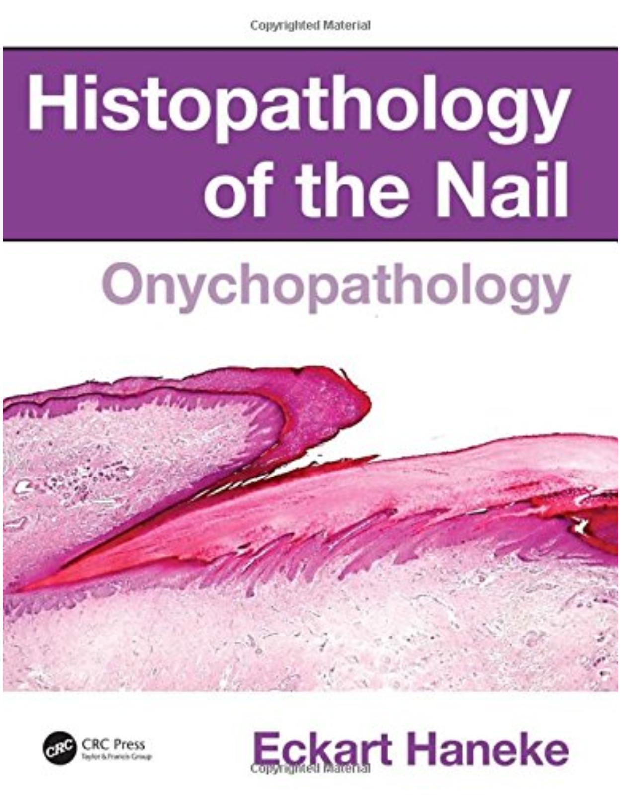 Histopathology of the Nail: Onychopathology