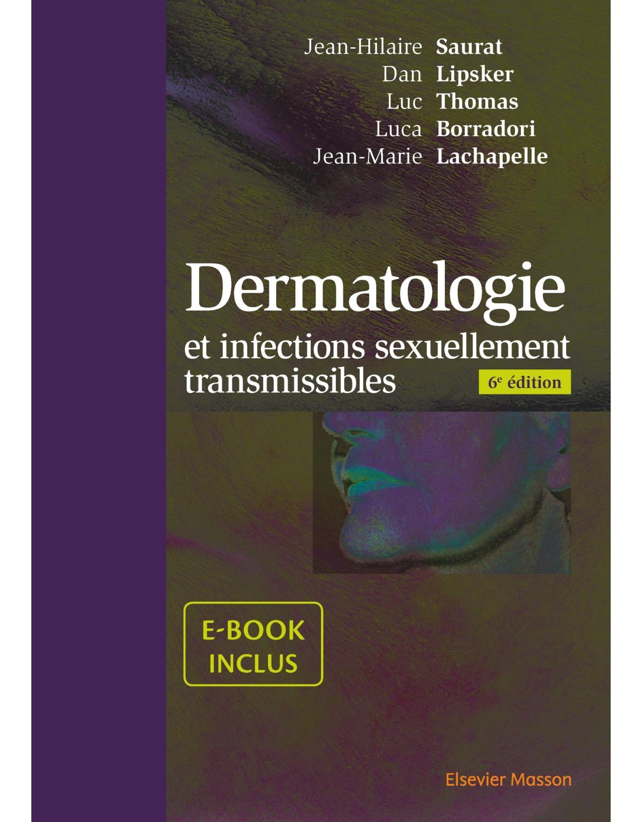Dermatologie Et Infections Sexuellement Transmissibles