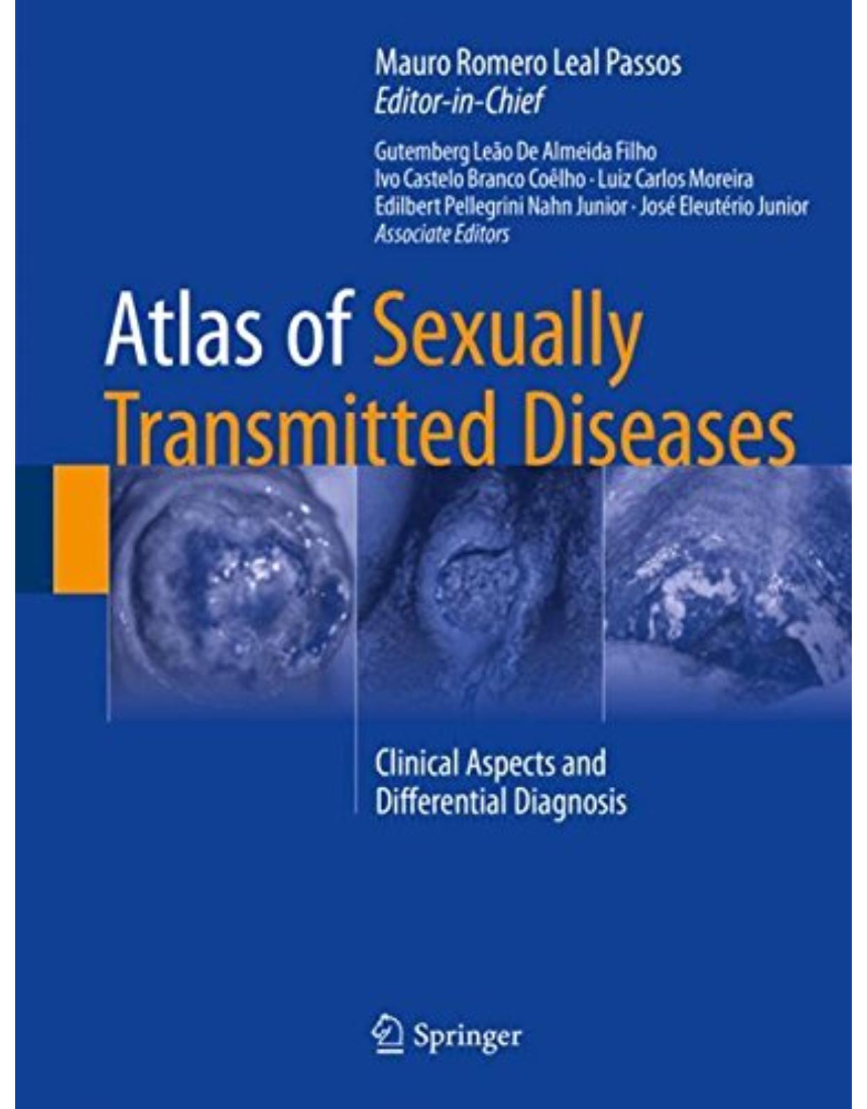 Atlas of Sexually Transmitted Diseases: Clinical Aspects and Differential Diagnosis 