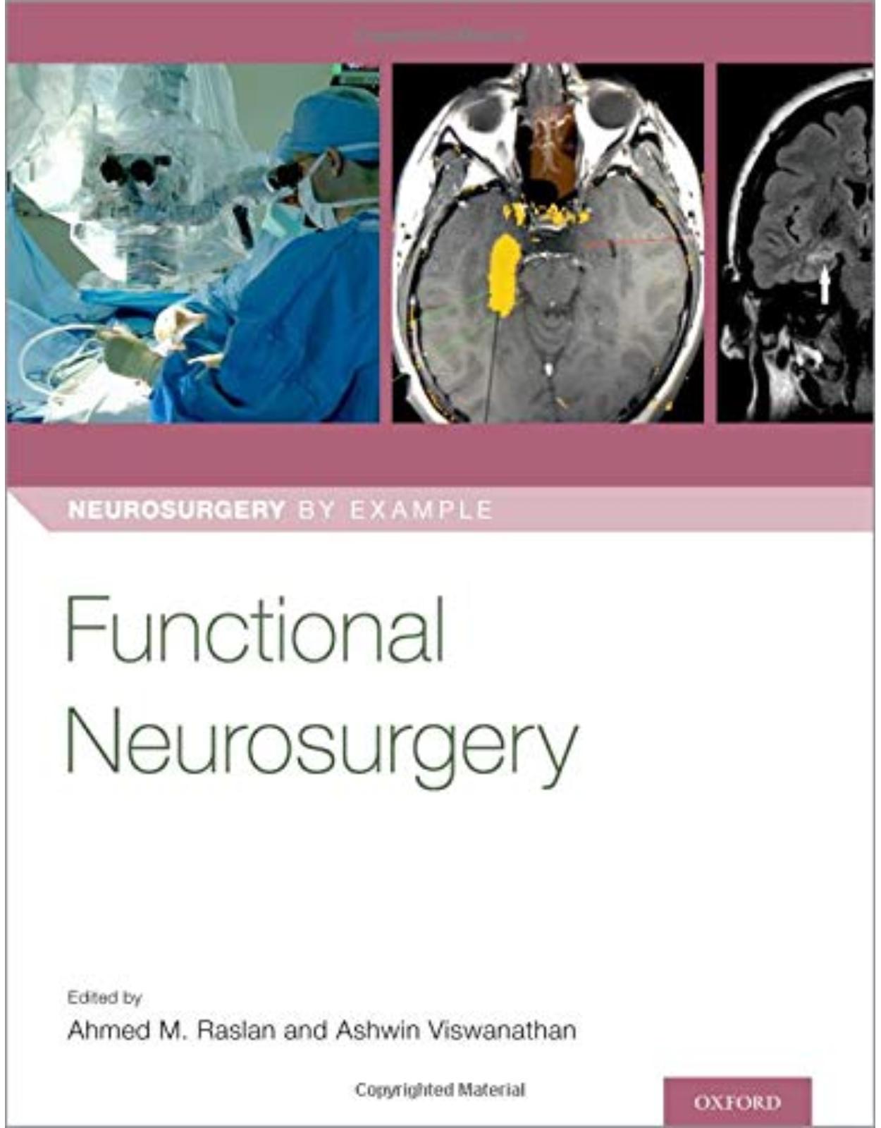 Functional Neurosurgery (Neurosurgery by Example) 