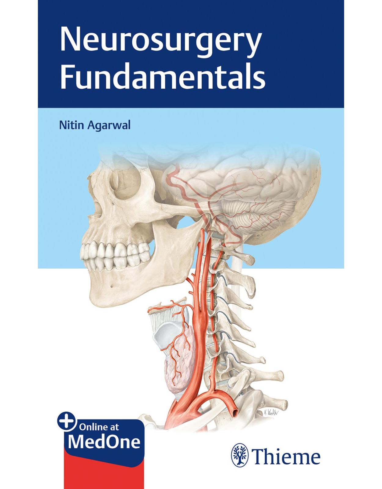 Neurosurgery Fundamentals 