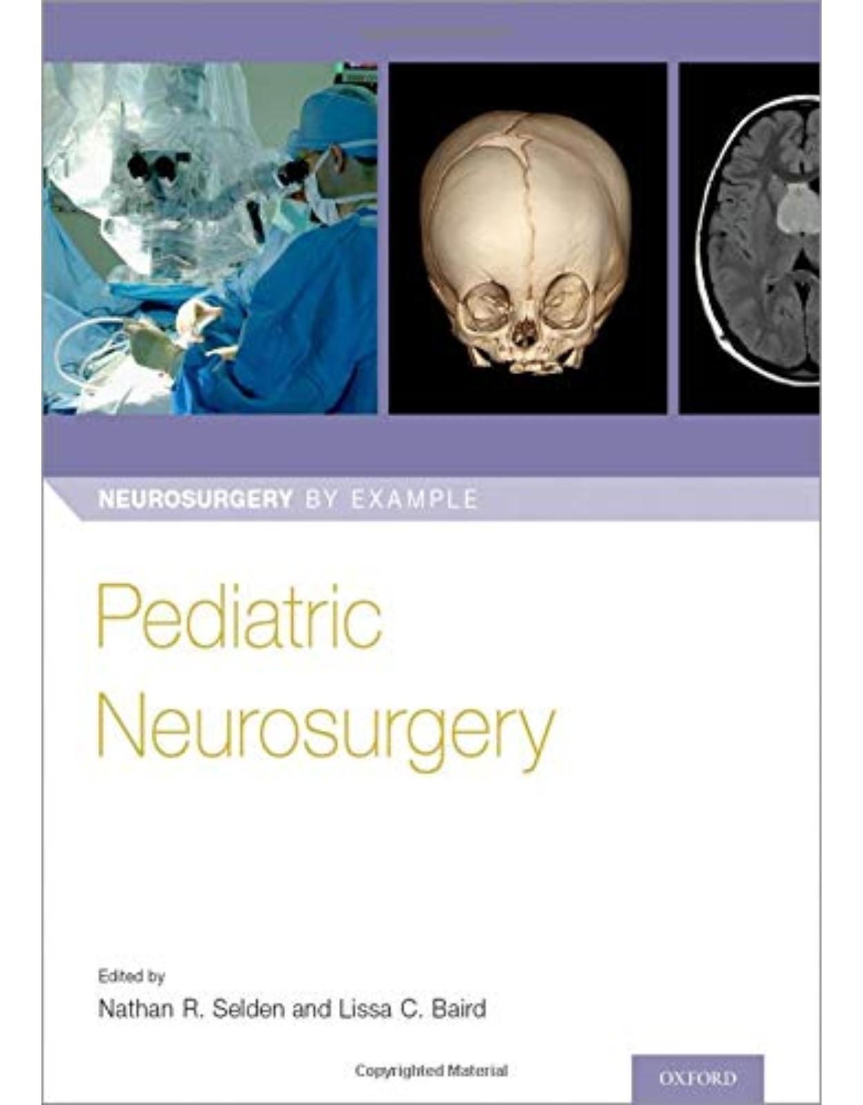 Pediatric Neurosurgery (Neurosurgery by Example)