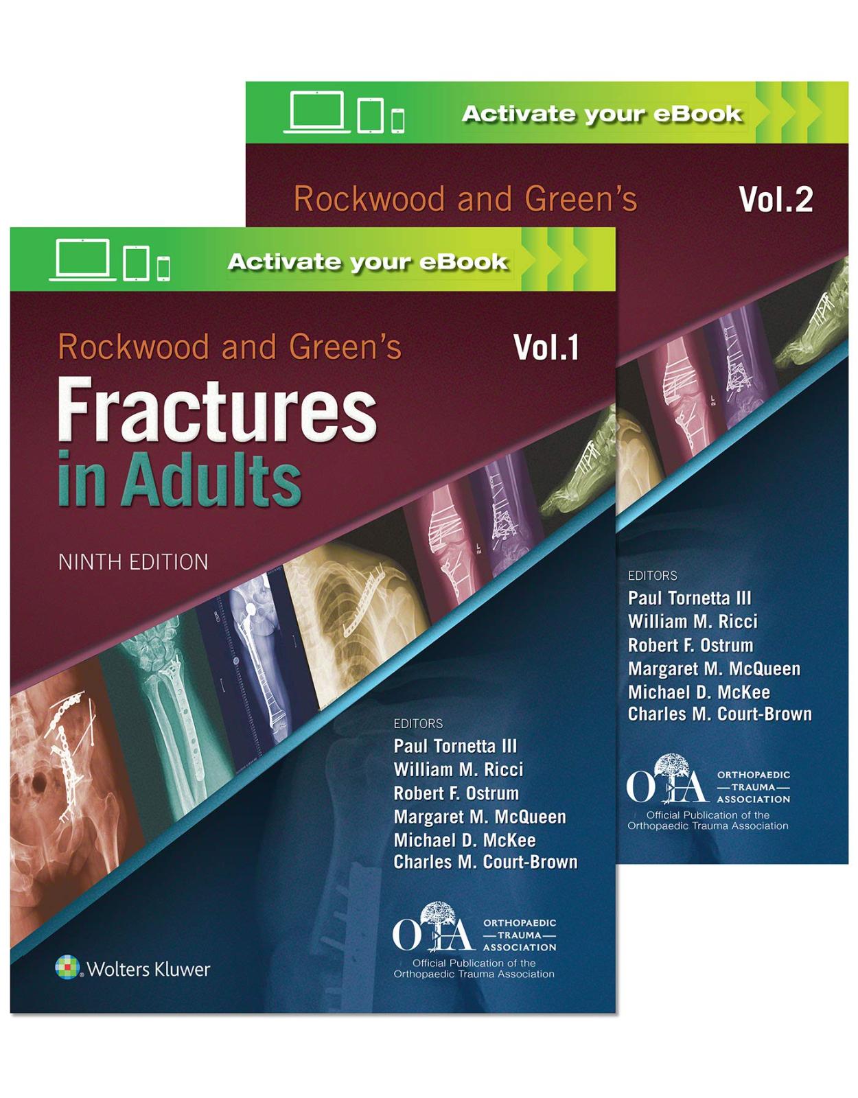 Rockwood and Greens Fractures in Adults