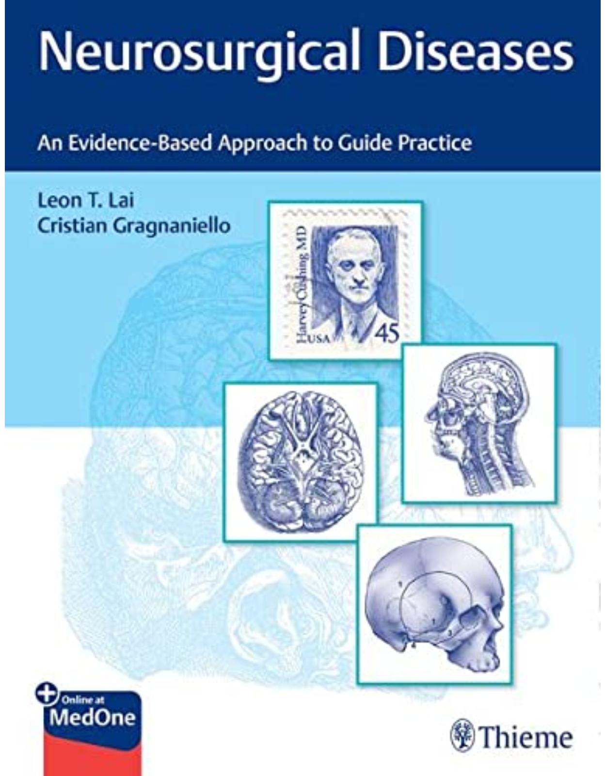 Neurosurgical Diseases: An Evidence-Based Approach to Guide Practice