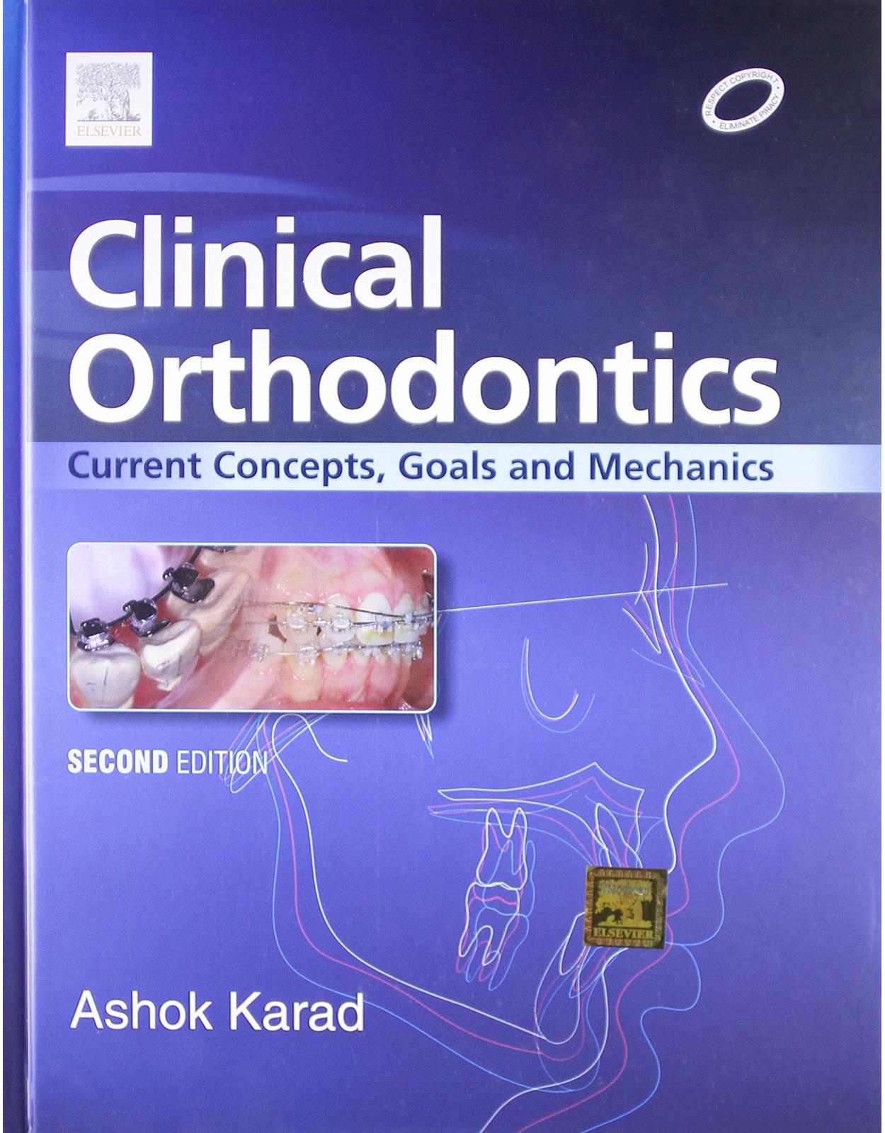 Clinical Orthodontics: Current Concepts, Goals And Mechanics