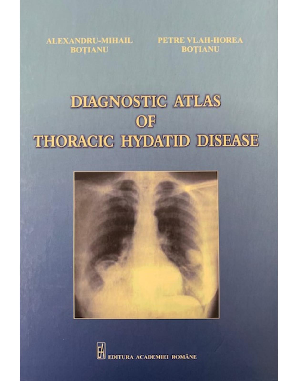 Diagnostic atlas of thoracic hydatid disease