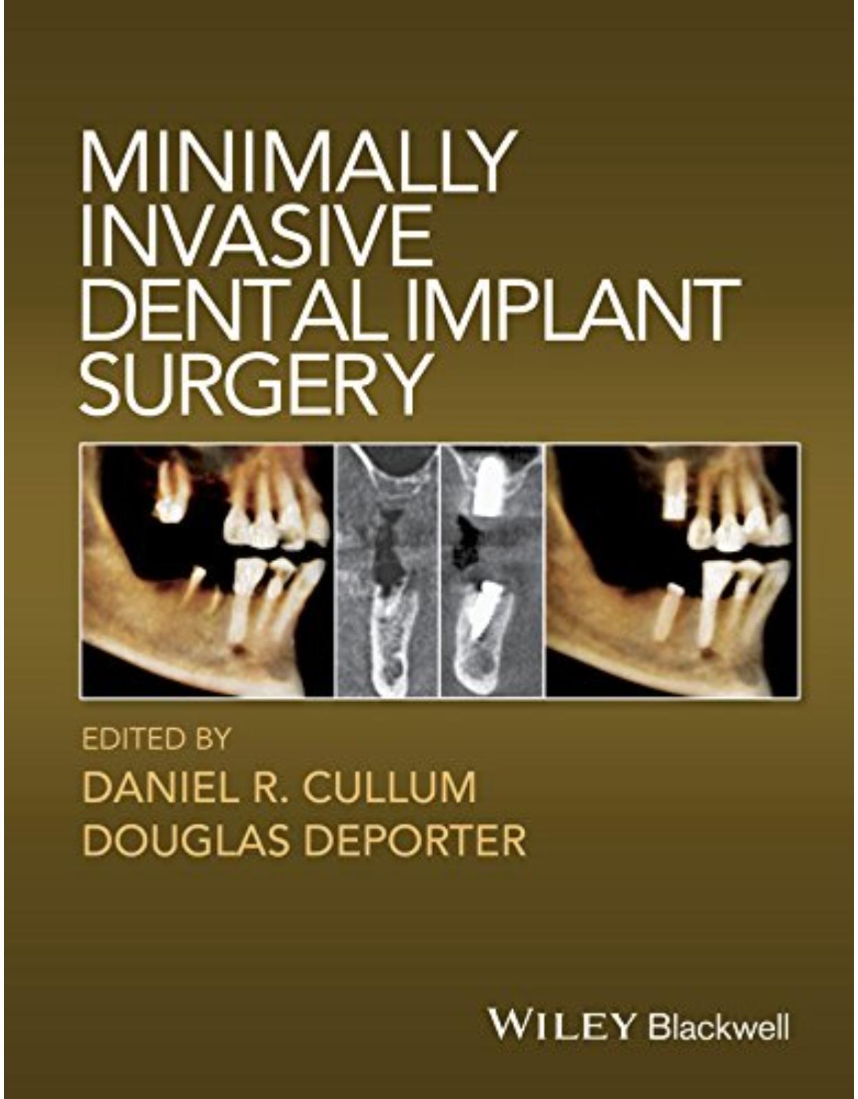 Minimally Invasive Dental Implant Surgery