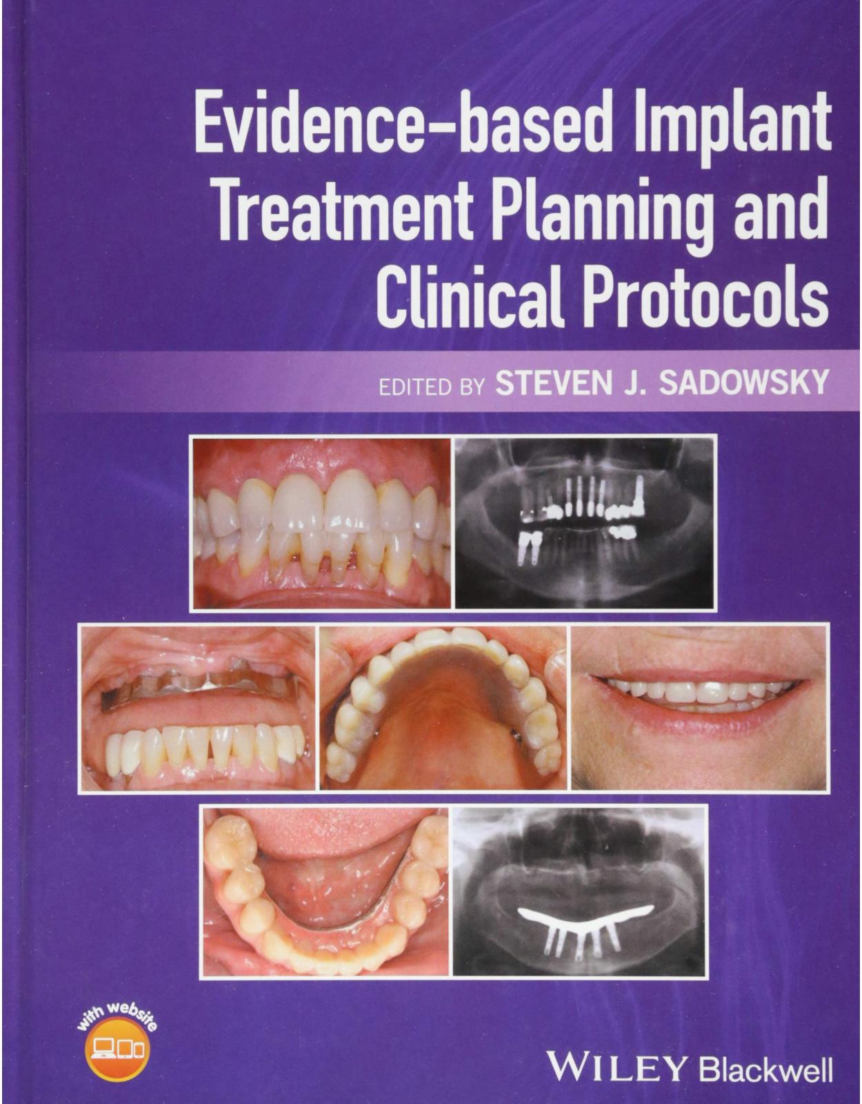 Evidence-Based Implant Treatment Planning and Clinical Protocols 
