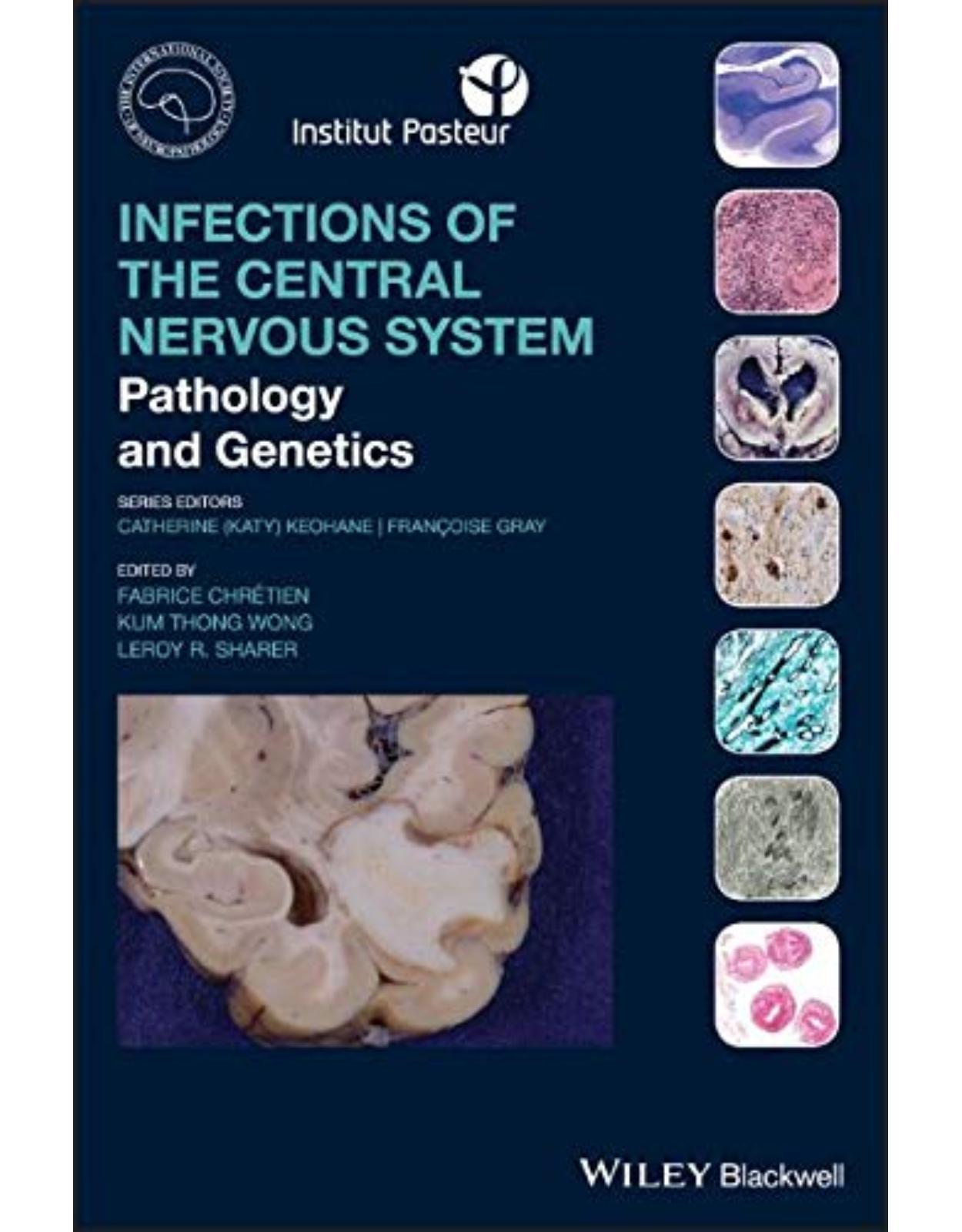 Infections of the Central Nervous System: Pathology and Genetics 