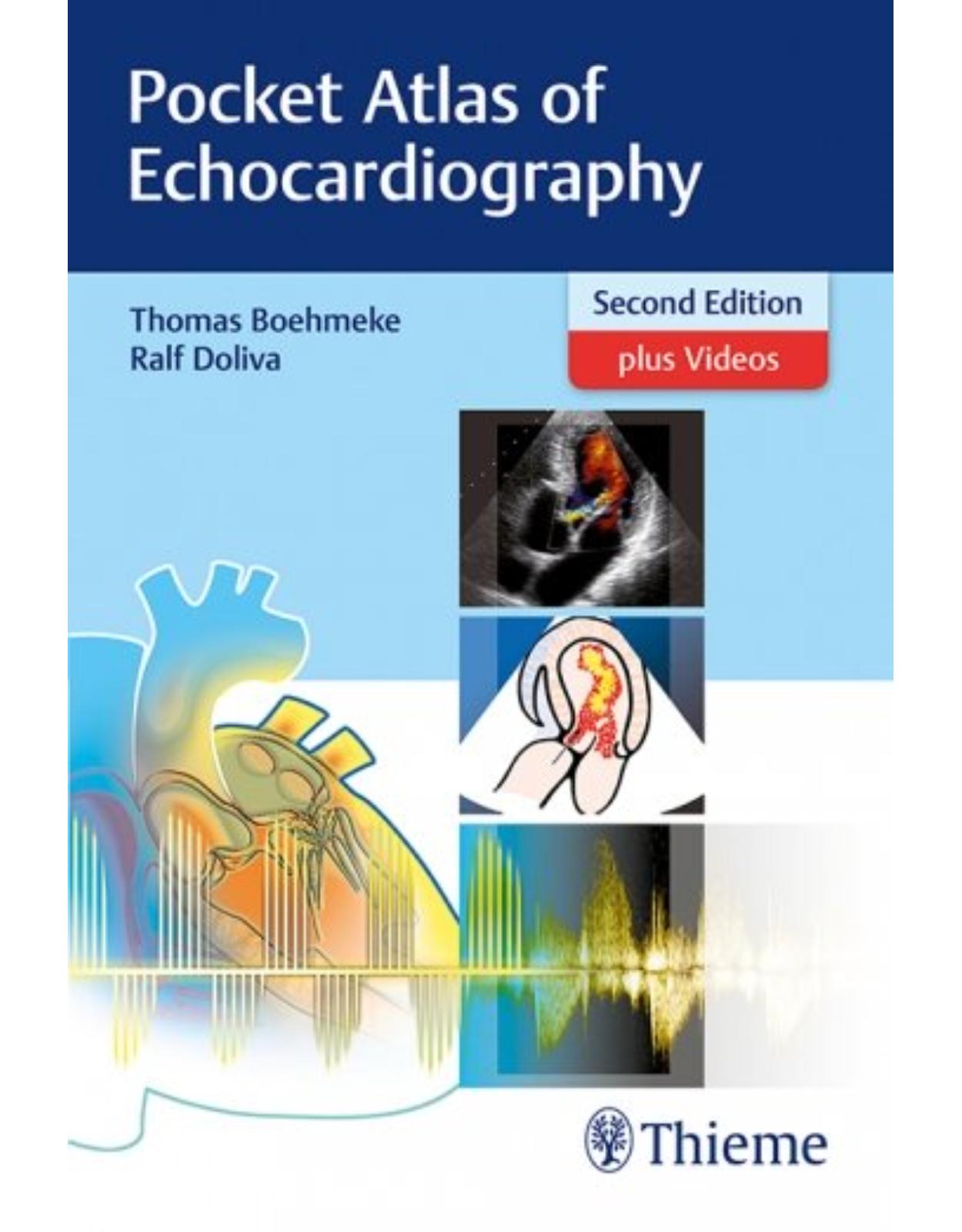 Pocket Atlas of Echocardiography 