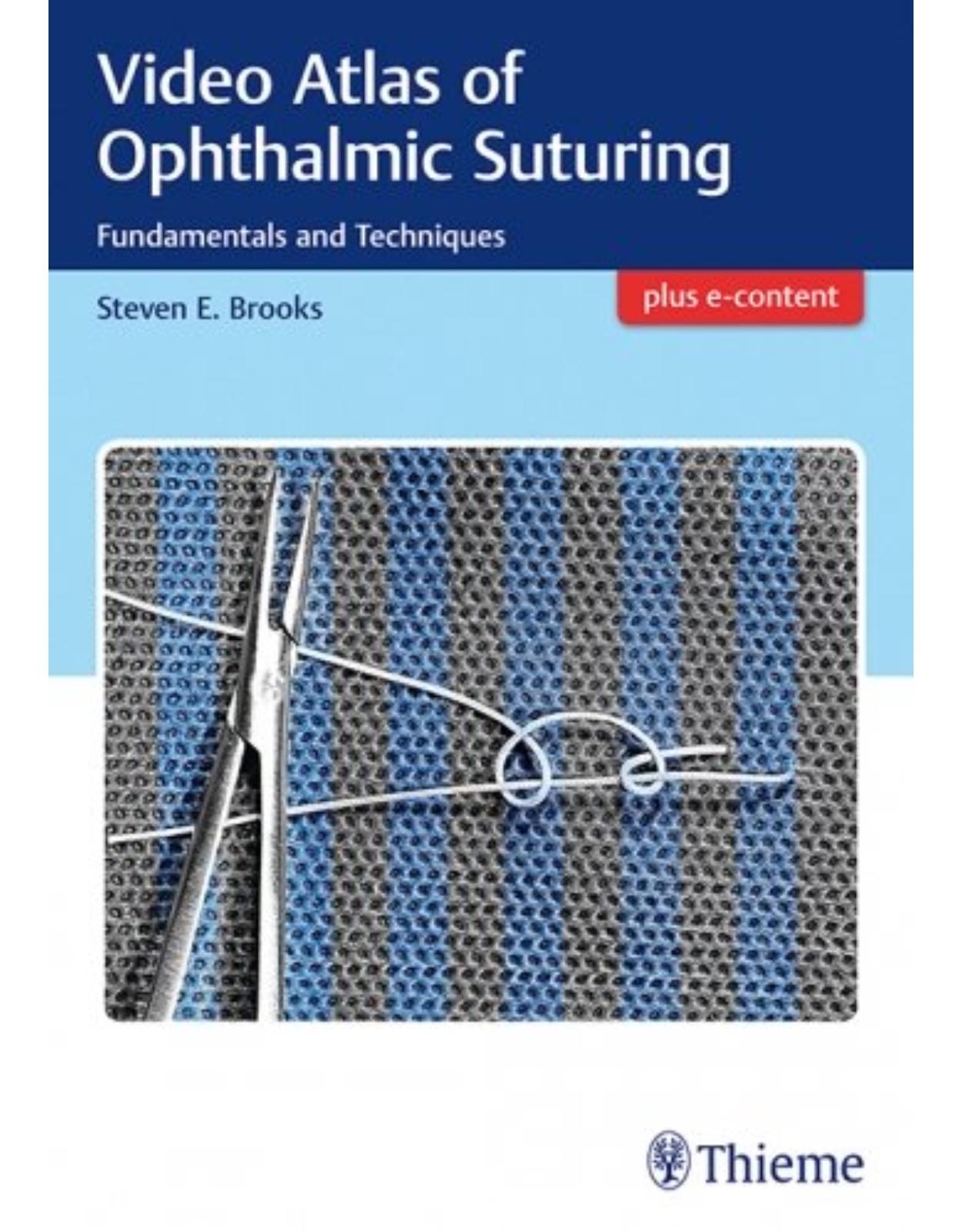 Video Atlas of Ophthalmic Suturing: Fundamentals and Techniques