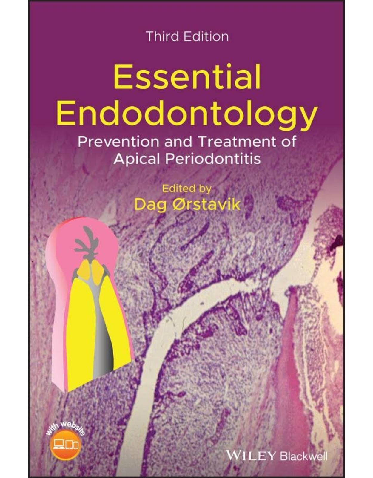 Essential Endodontology: Prevention and Treatment of Apical Periodontitis