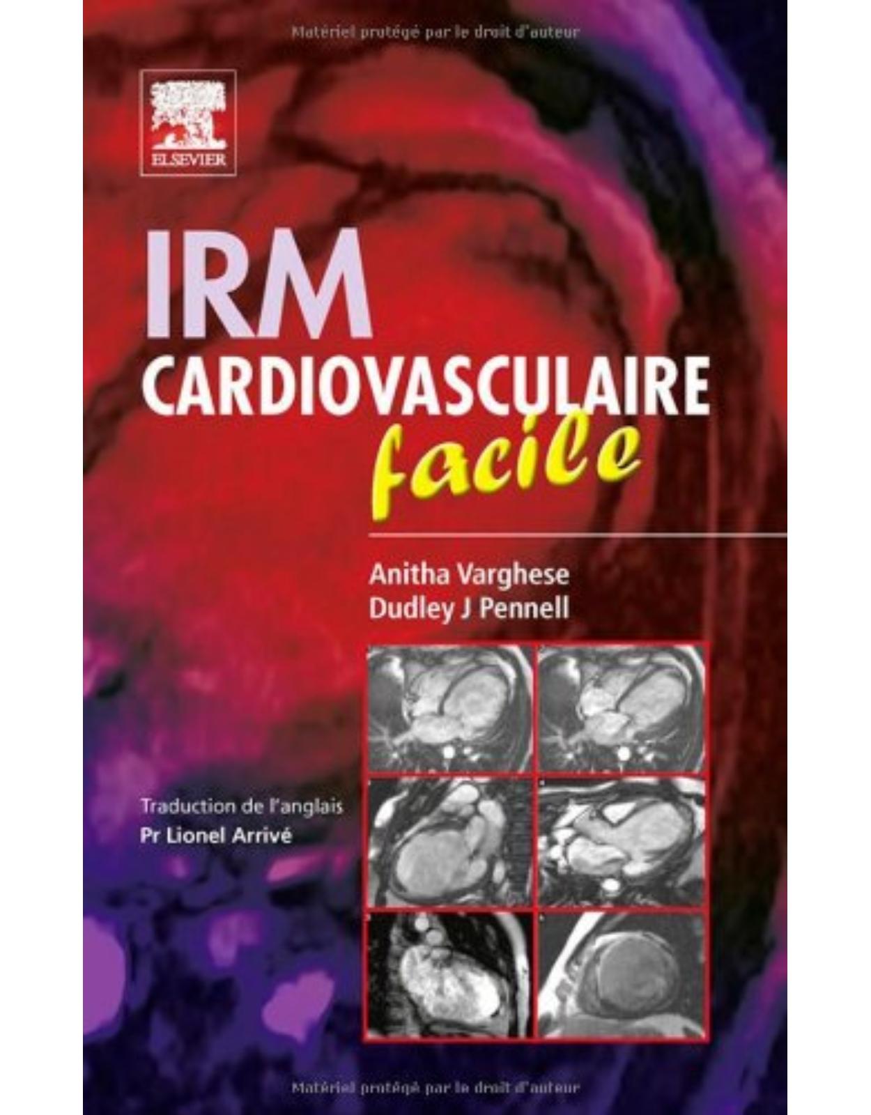 IRM cardiovasculaire facile