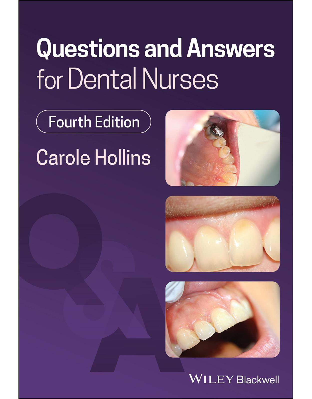 Questions and Answers for Dental Nurses 