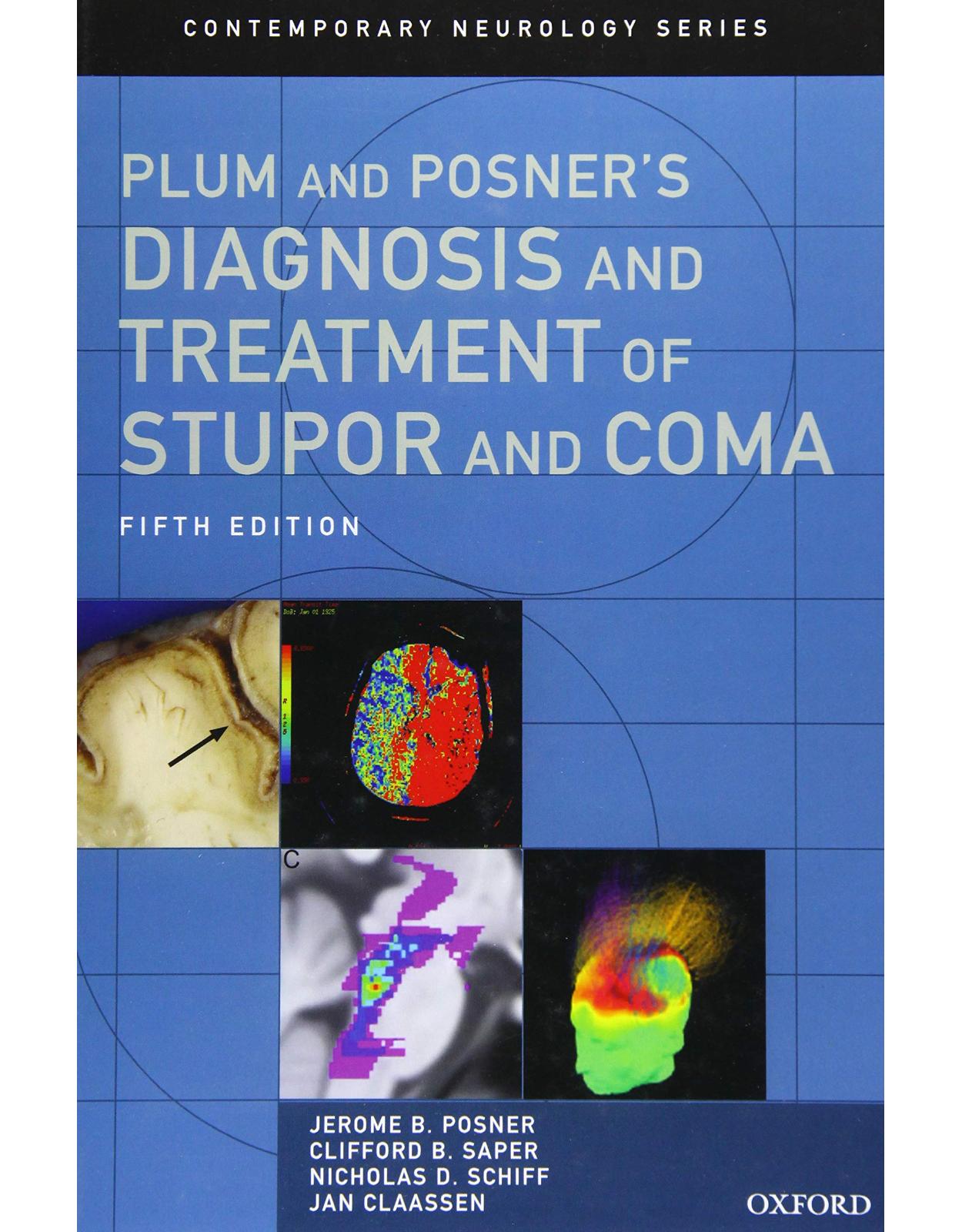 Plum and Posner's Diagnosis and Treatment of Stupor and Coma