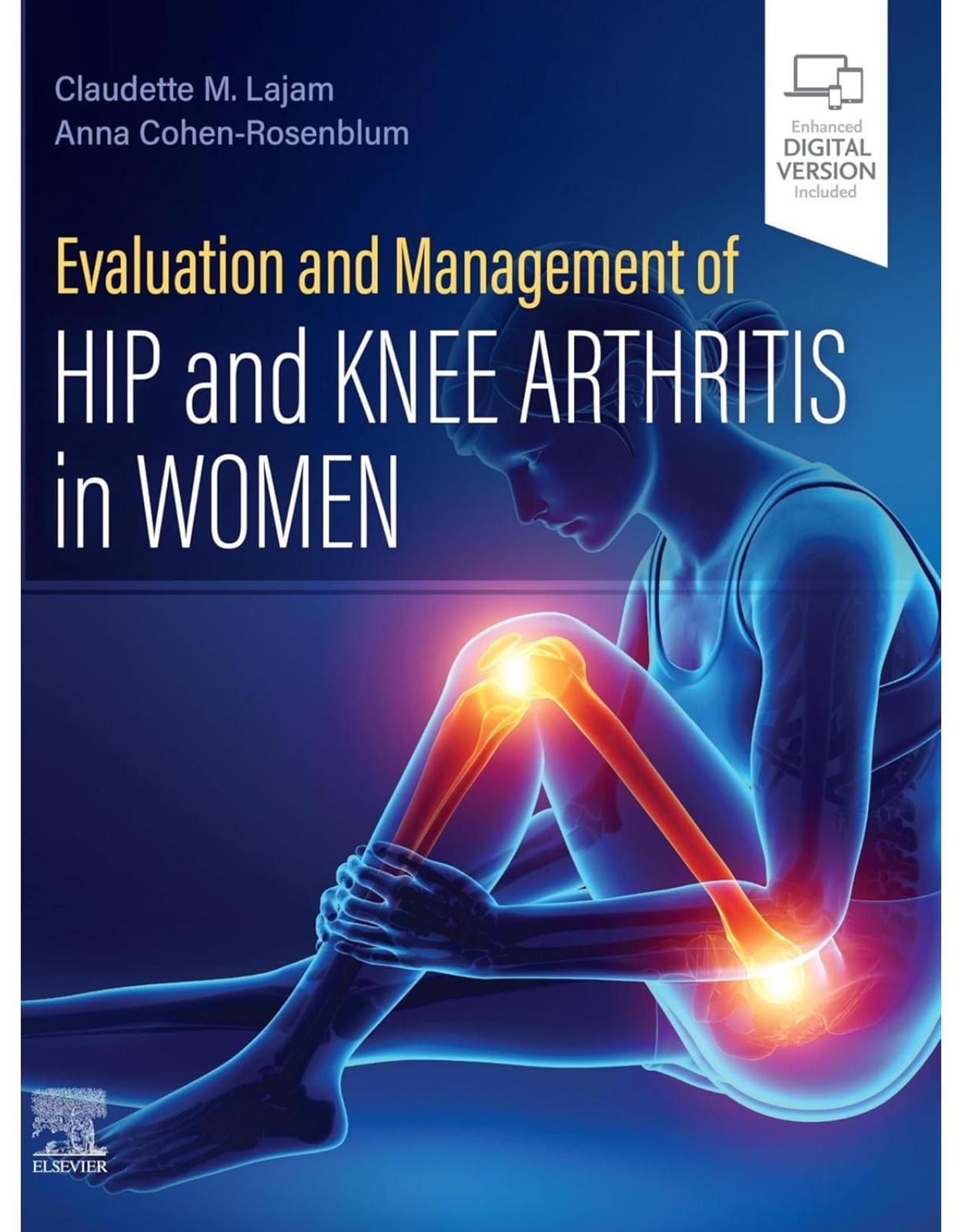 Evaluation and Management of Hip and Knee Arthritis in Women