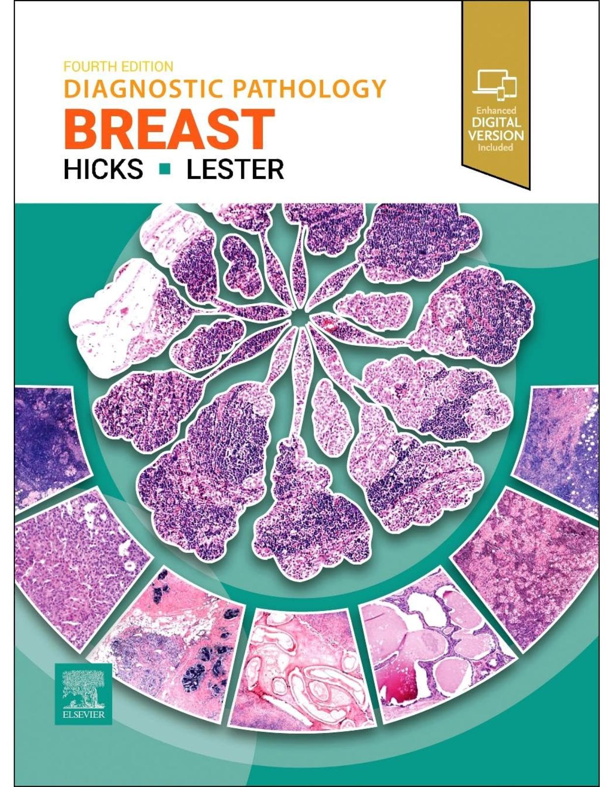 Diagnostic Pathology: Breast