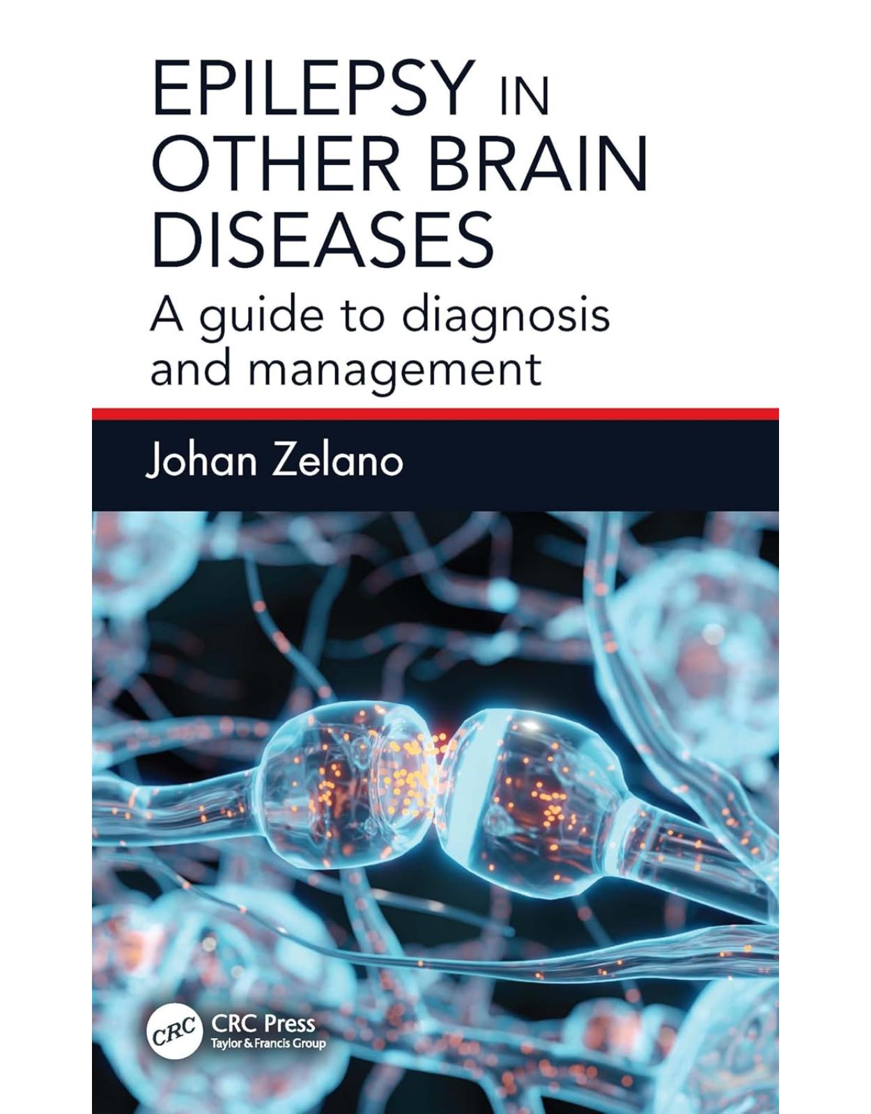 Epilepsy in Other Brain Diseases: A Guide to Diagnosis and Management 