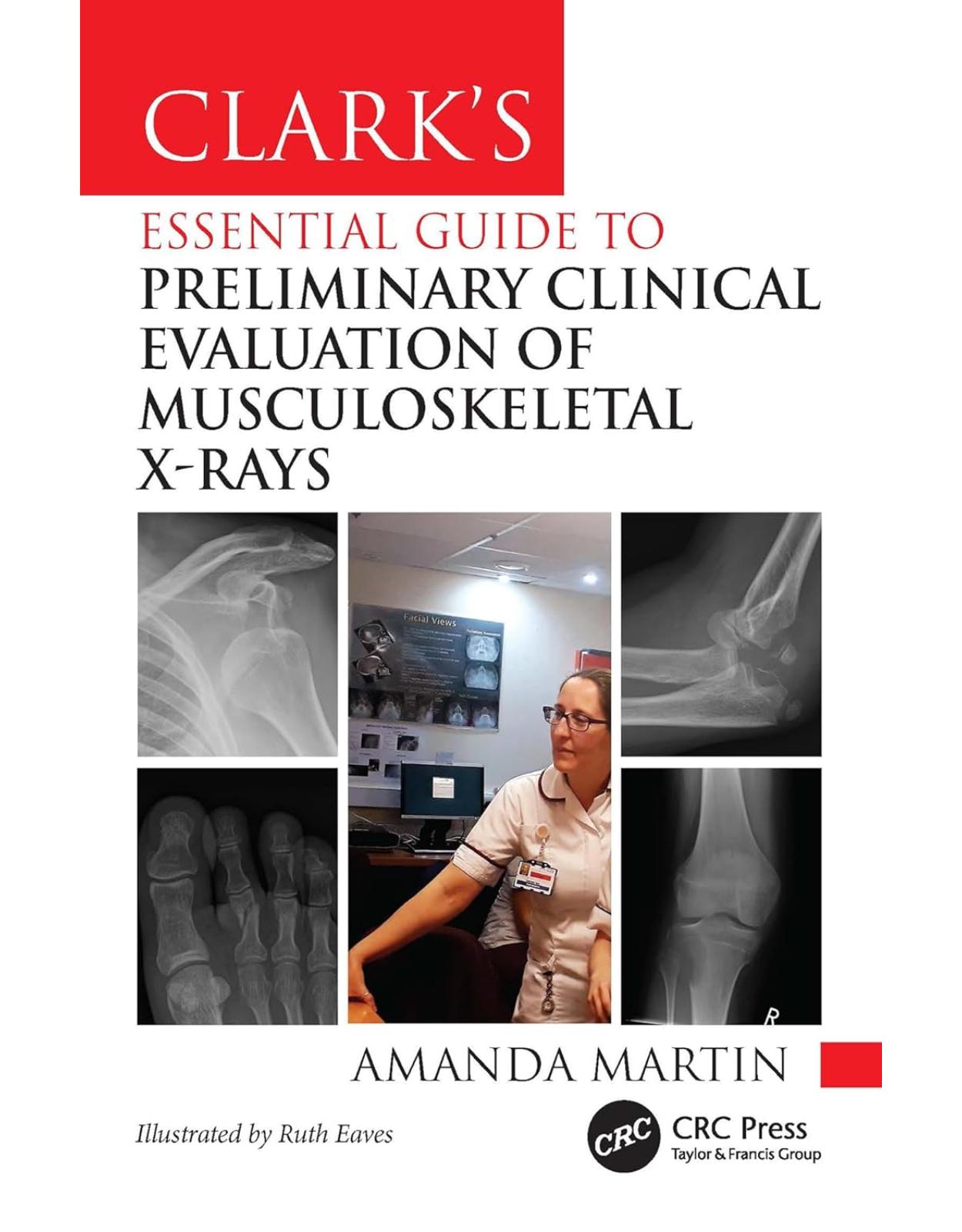 Clark’s Essential Guide to Preliminary Clinical Evaluation of Musculoskeletal X-rays