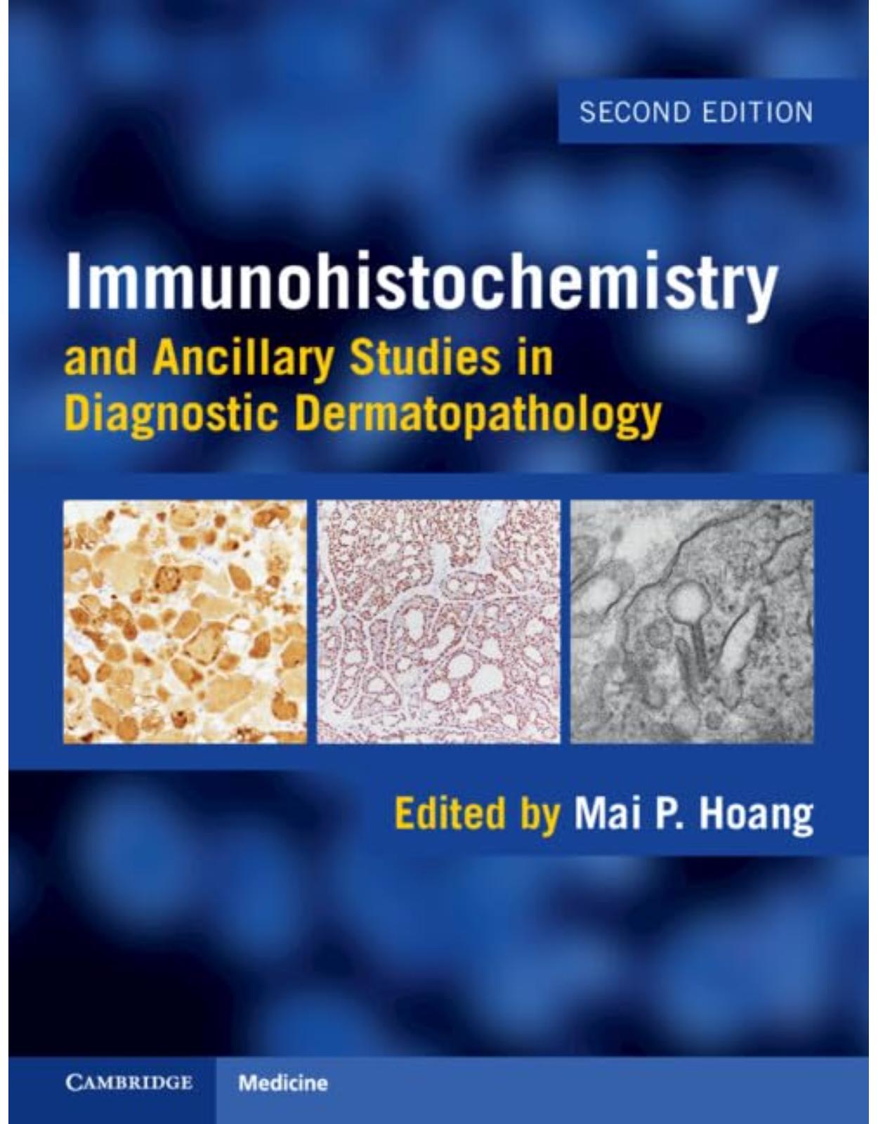 Immunohistochemistry and Ancillary Studies in Diagnostic Dermatopathology 