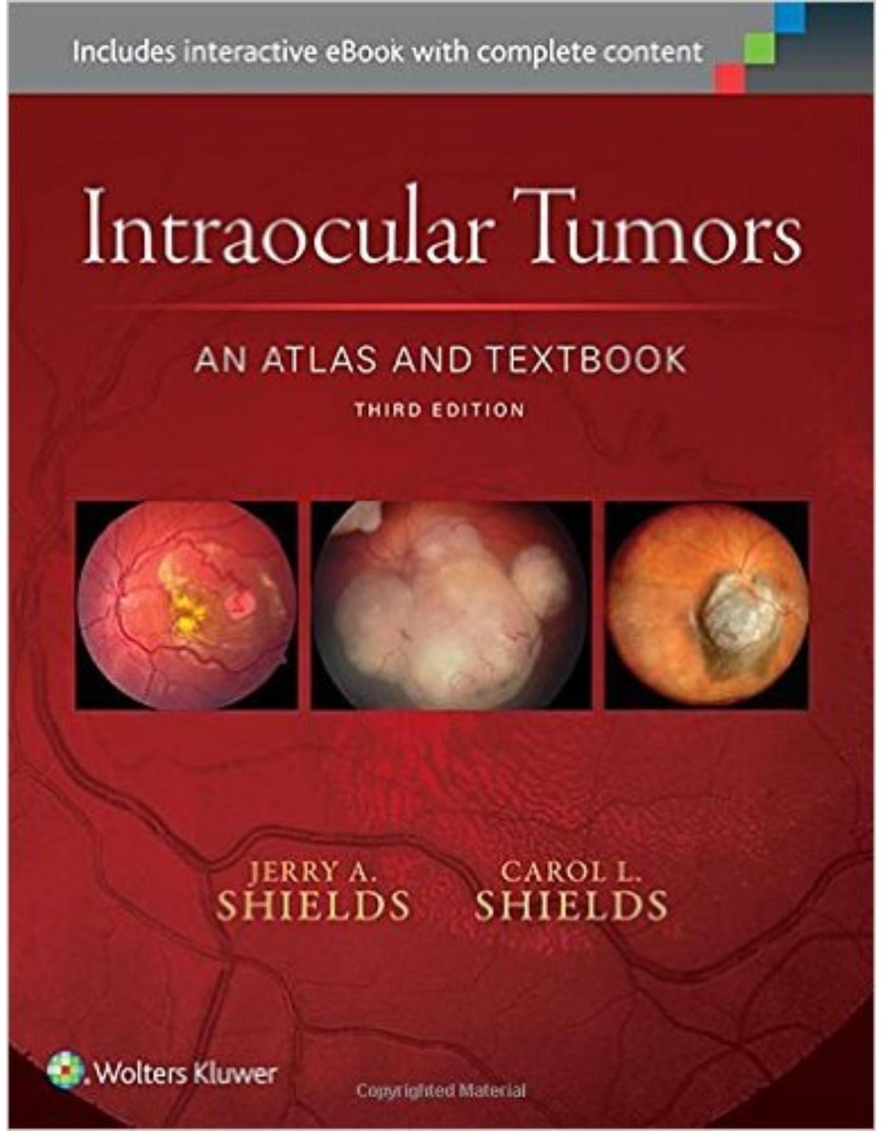 Intraocular Tumors: An Atlas and Textbook Third Edition