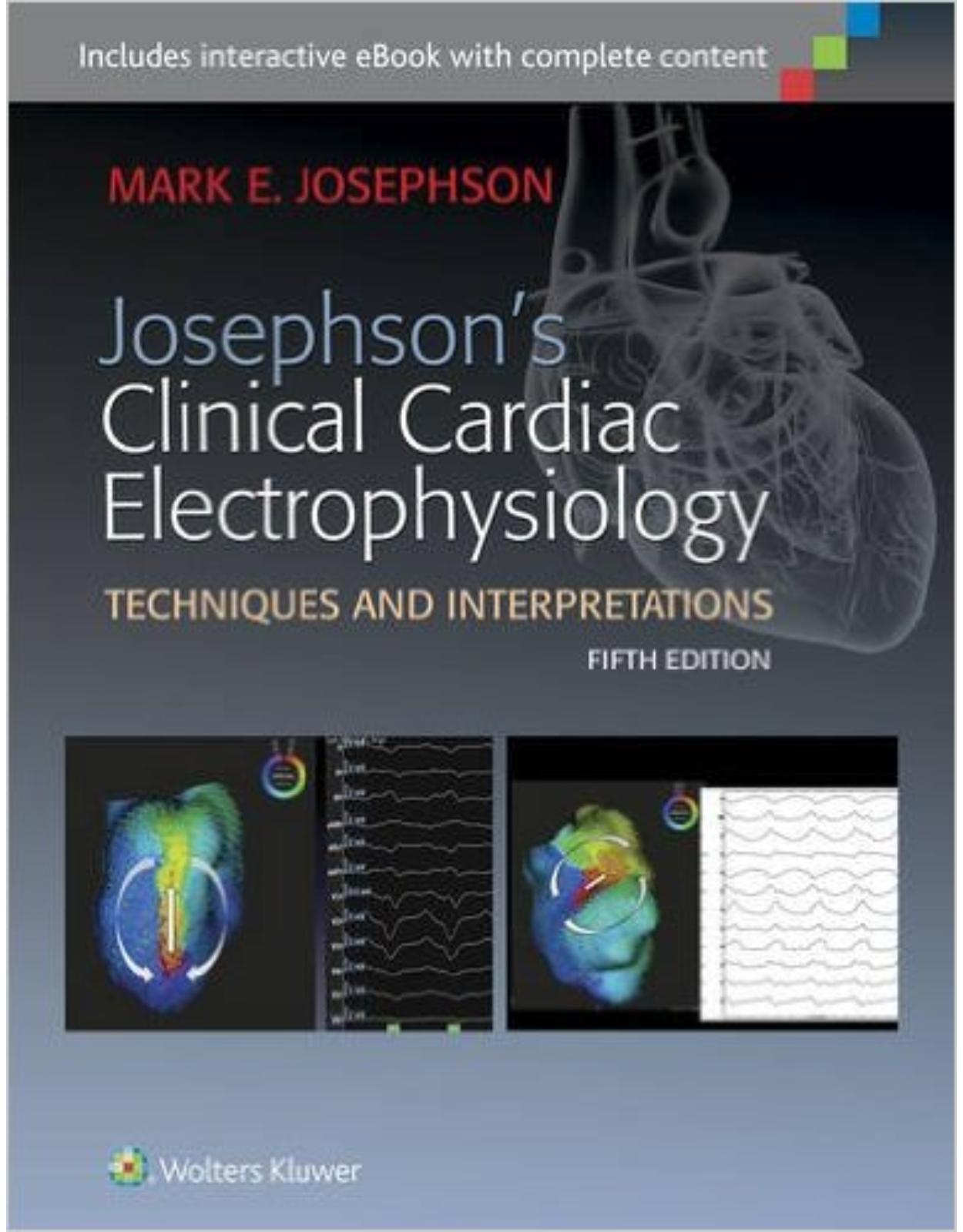 Josephson's Clinical Cardiac Electrophysiology 