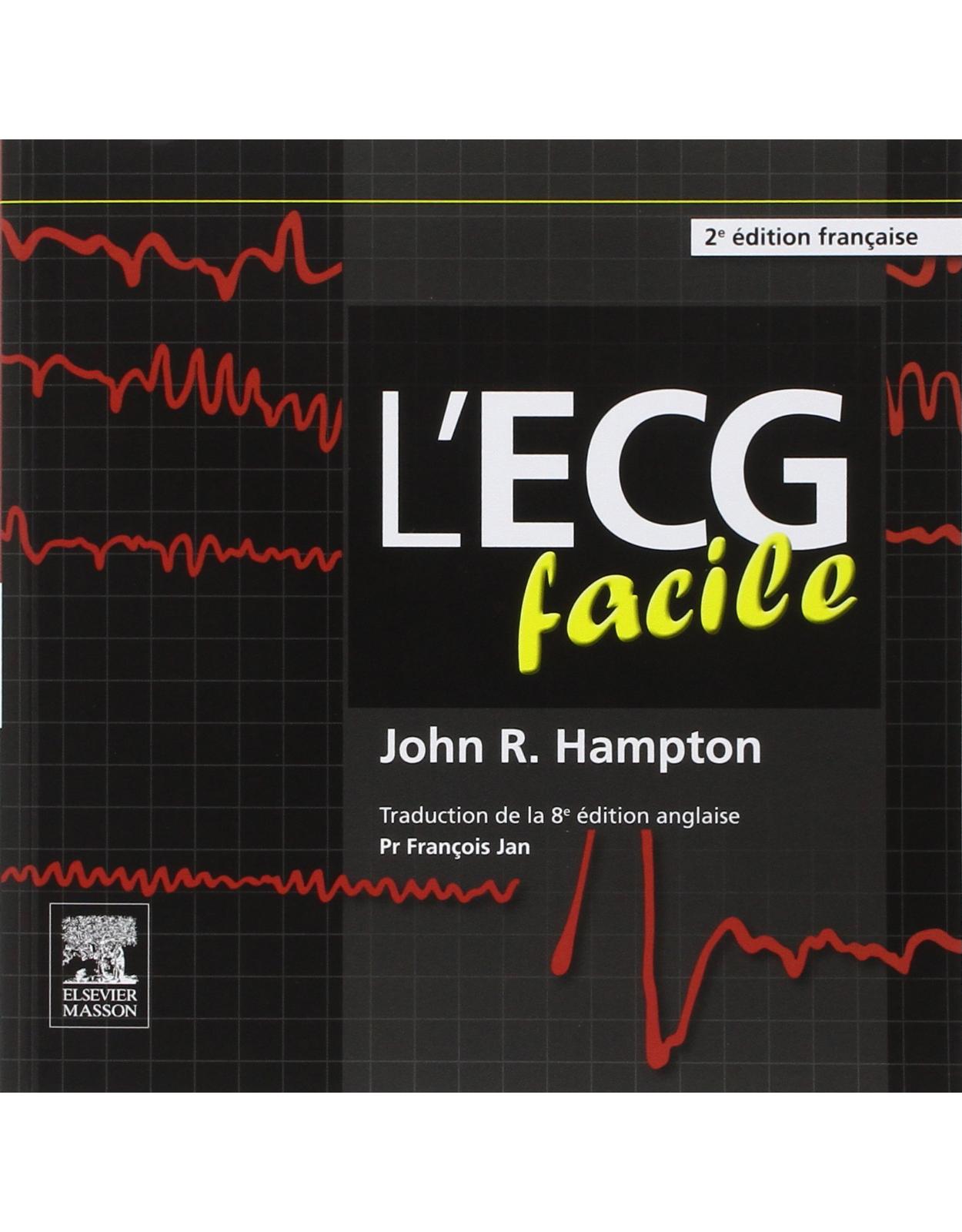 L’ecg Facile