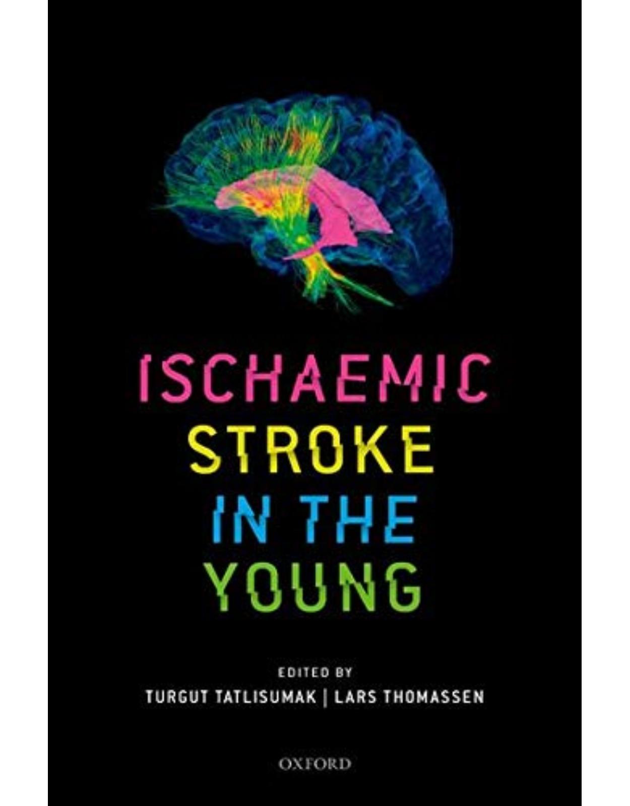 Ischaemic Stroke in the Young