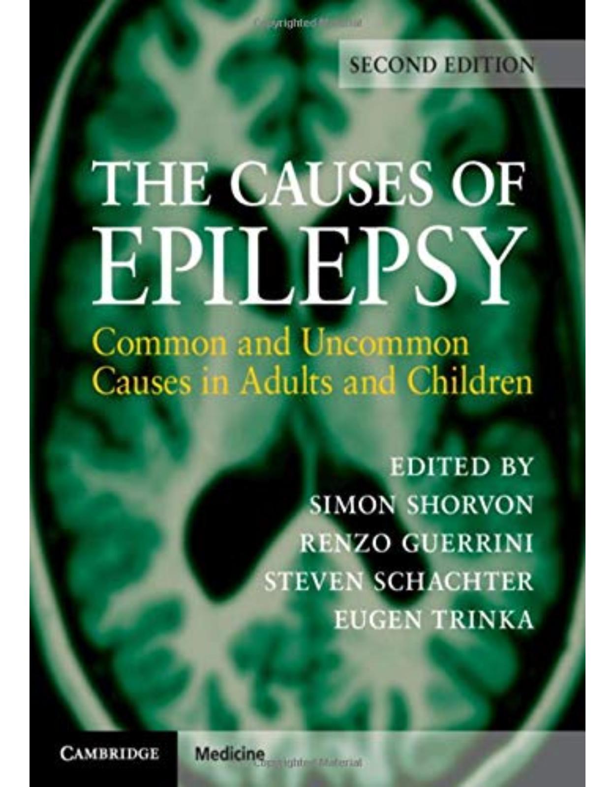 The Causes of Epilepsy: Common and Uncommon Causes in Adults and Children