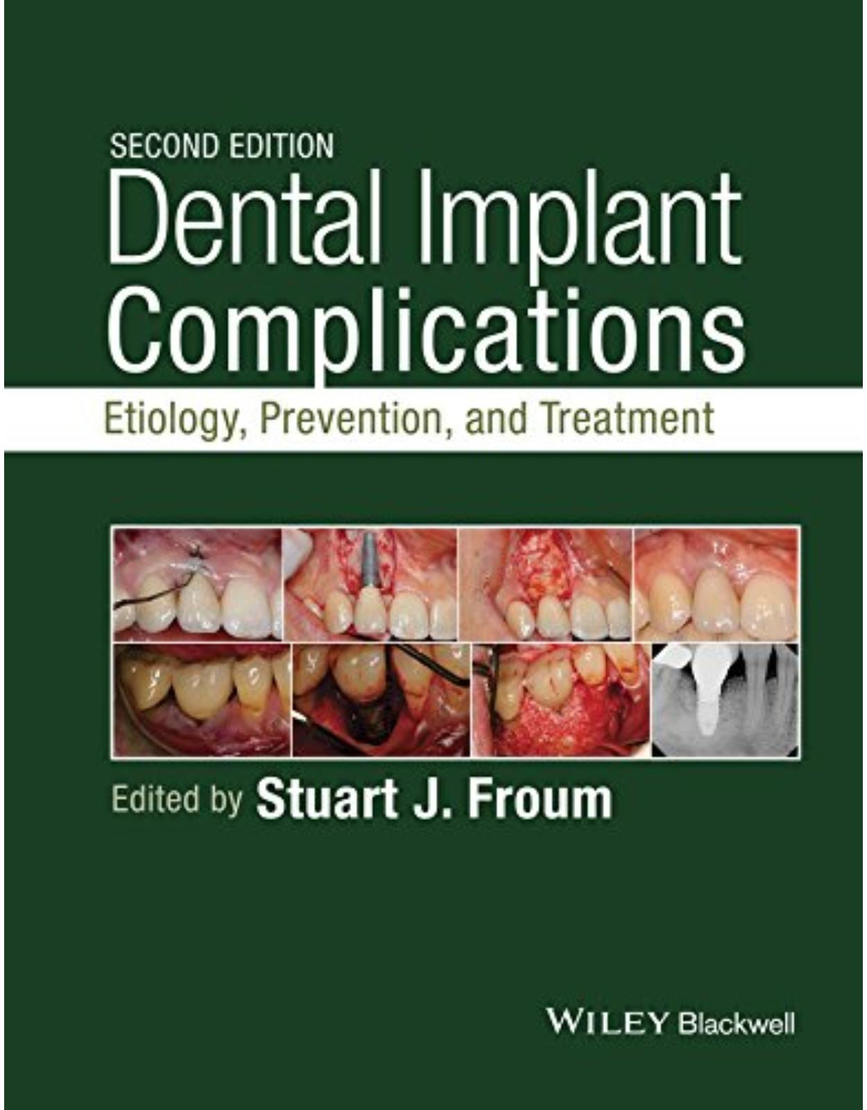 Dental Implant Complications