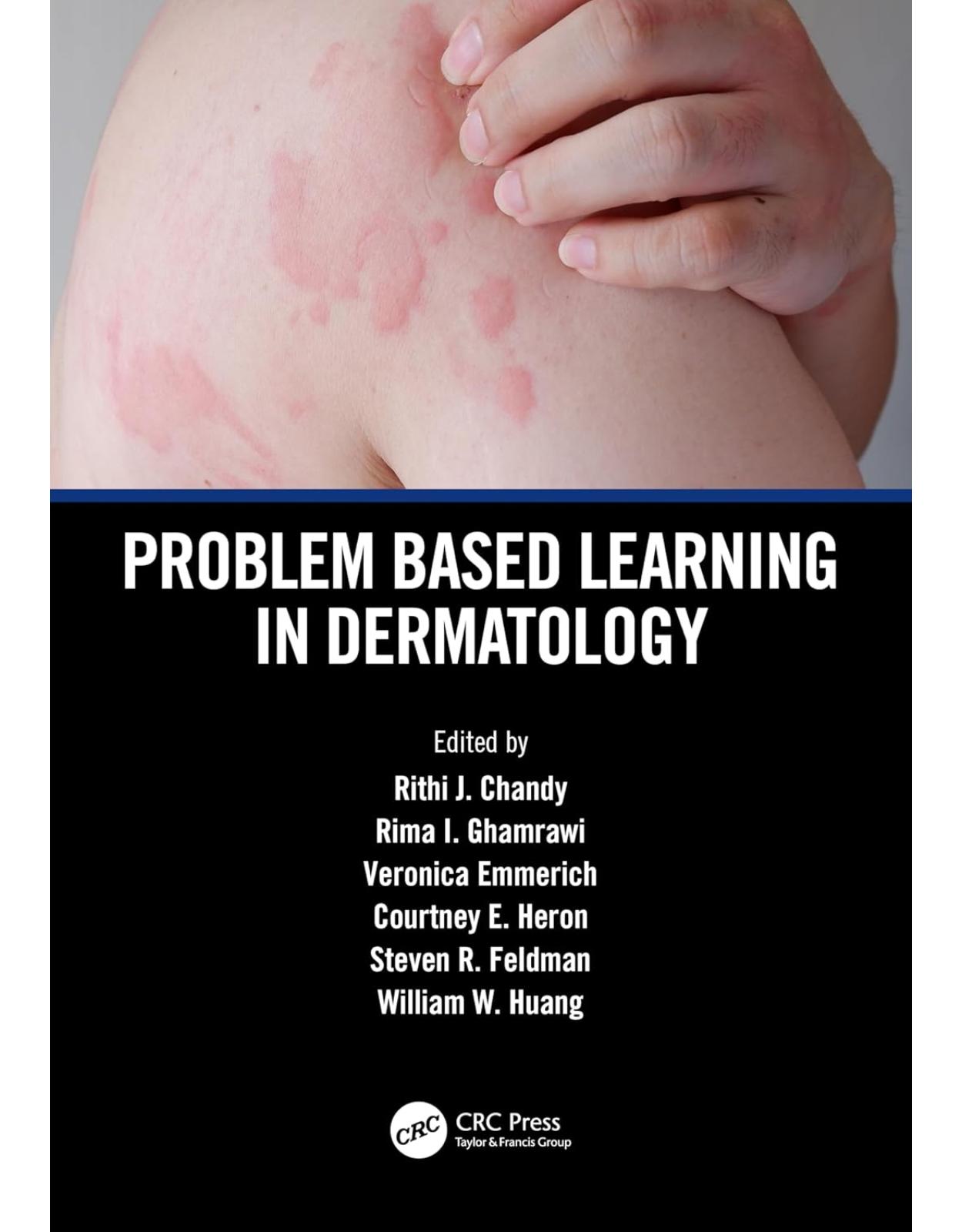 Problem Based Learning in Dermatology 