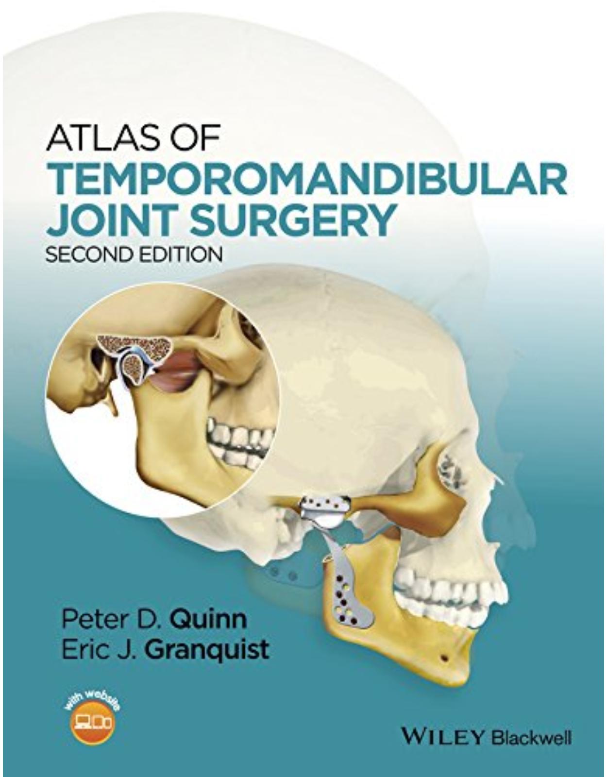 Atlas of Temporomandibular Joint Surgery 2nd Edition