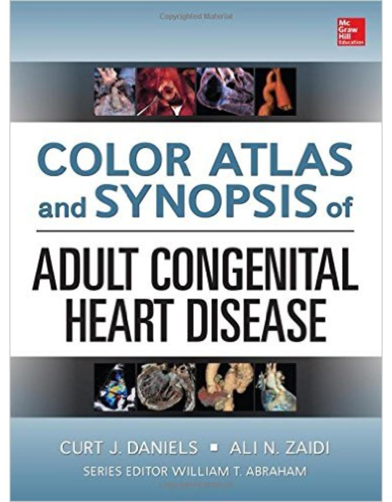 Color Atlas and Synopsis of Adult Congenital Heart Disease 1st Edition