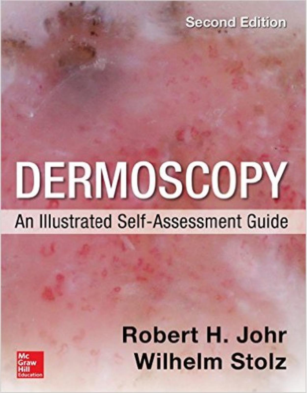 Dermoscopy: An Illustrated Self-Assessment Guide, 2/e 2nd Edition