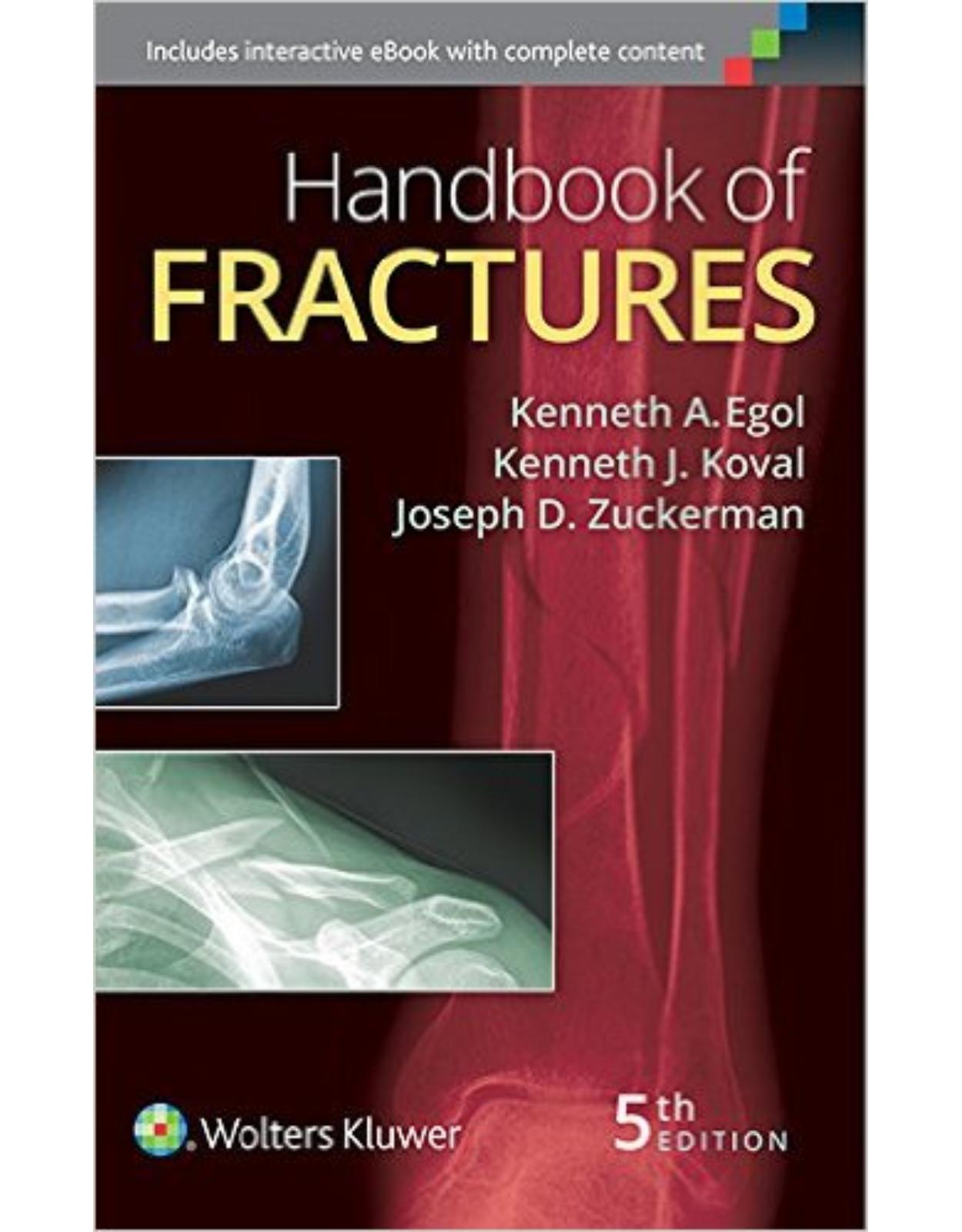Handbook of Fractures Fifth Edition