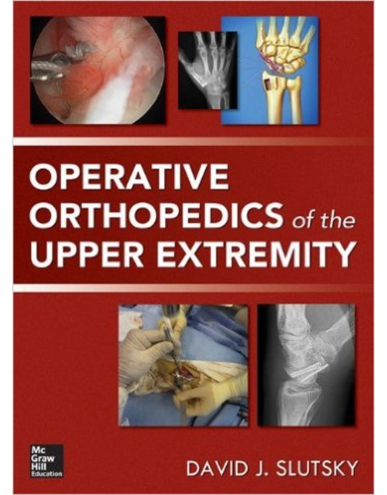 Operative Orthopedics of the Upper Extremity 1st Edition