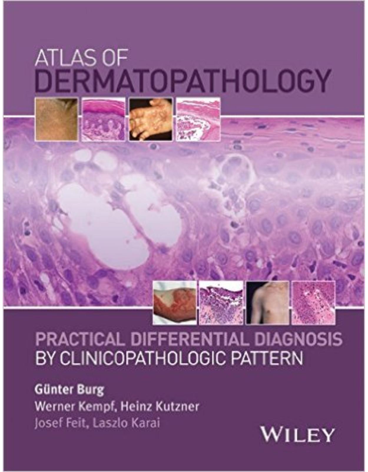 Atlas of Dermatopathology: Practical Differential Diagnosis by Clinicopathologic Pattern 1st Edition