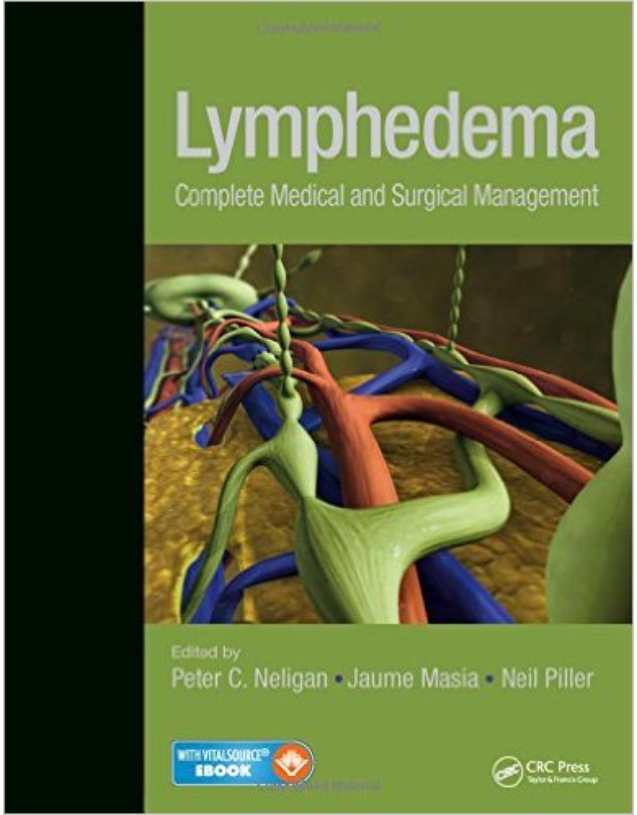 Lymphedema: Complete Medical and Surgical Management 1 Har/Psc/ Edition