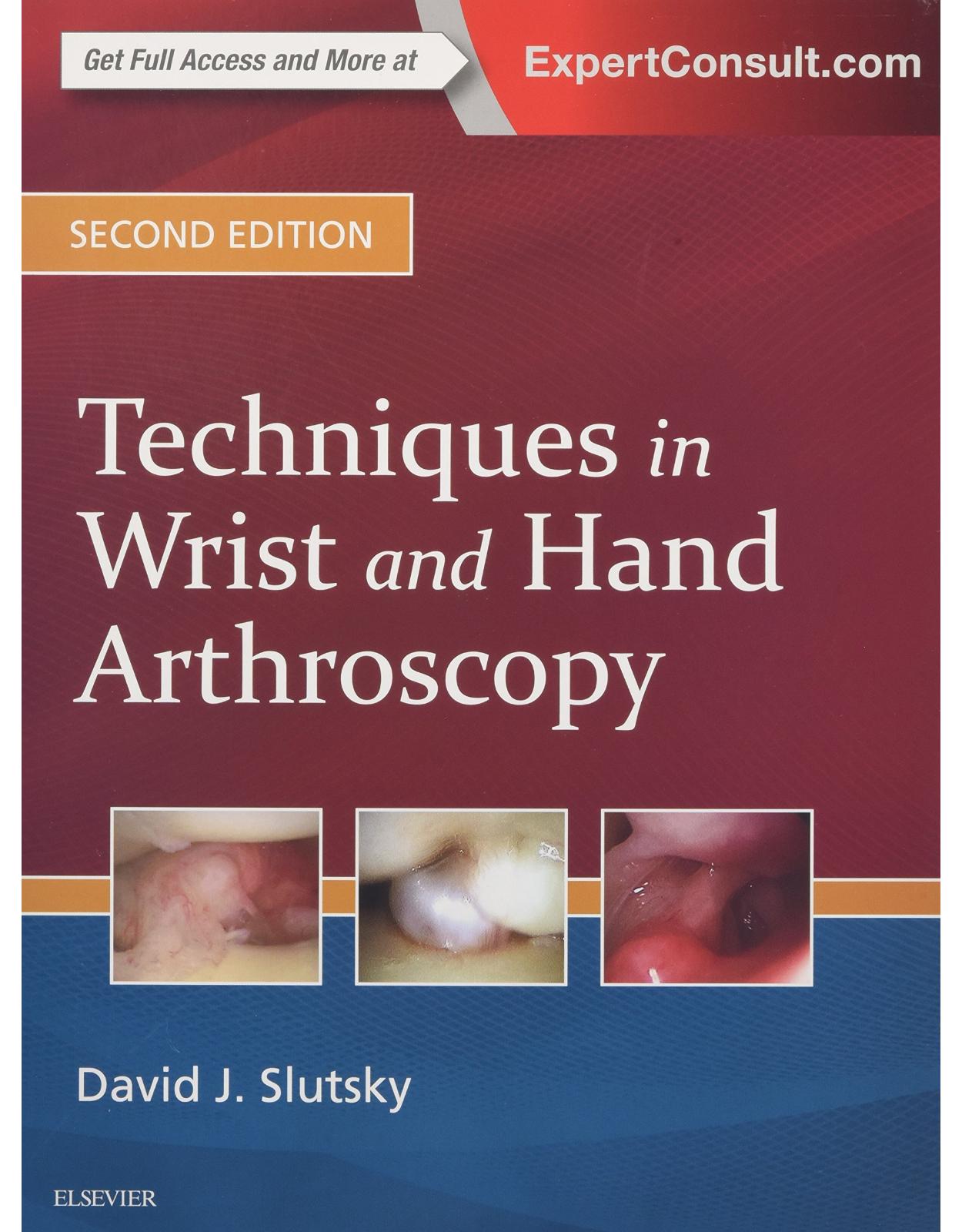 Techniques in Wrist and Hand Arthroscopy, 2nd Edition