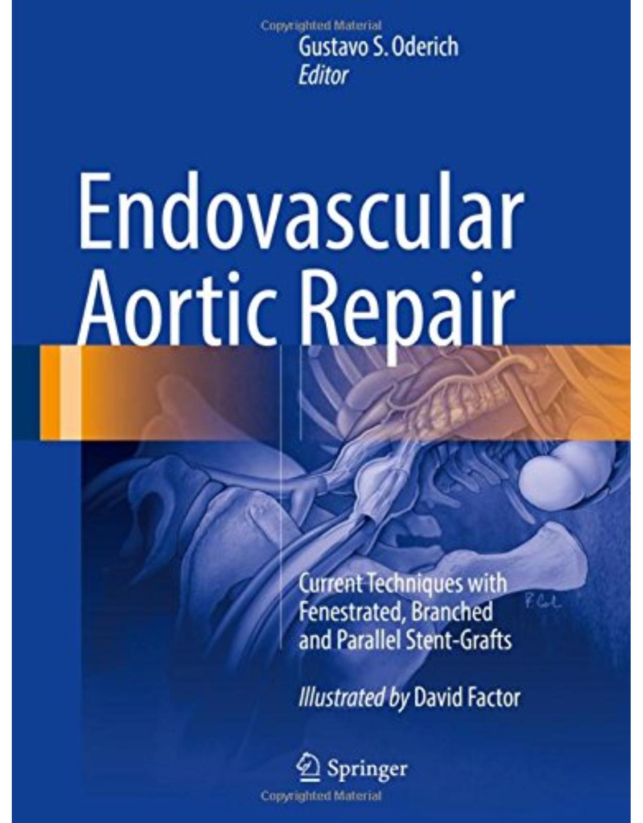 Endovascular Aortic Repair: Current Techniques with Fenestrated, Branched and Parallel Stent-Grafts