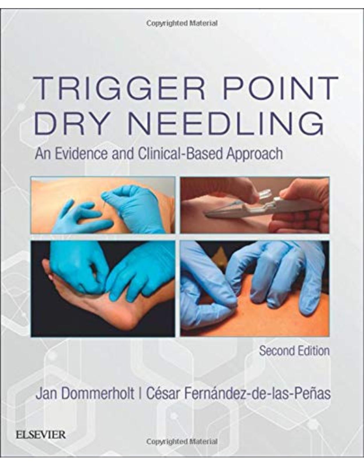 Trigger Point Dry Needling: An Evidence and Clinical-Based Approach, 2e