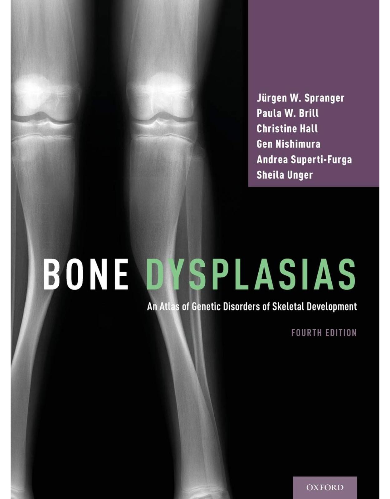 Bone Dysplasias: An Atlas of Genetic Disorders of Skeletal Development