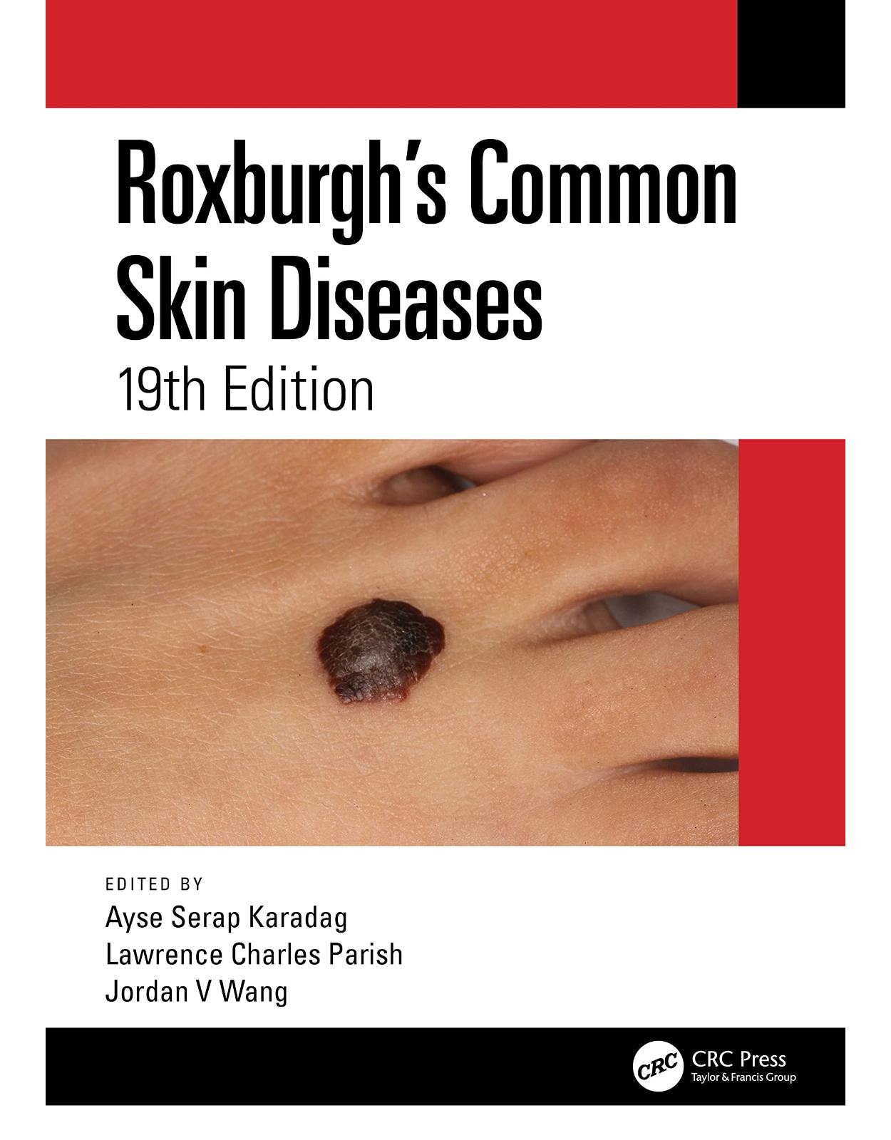 Roxburgh’s Common Skin Diseases