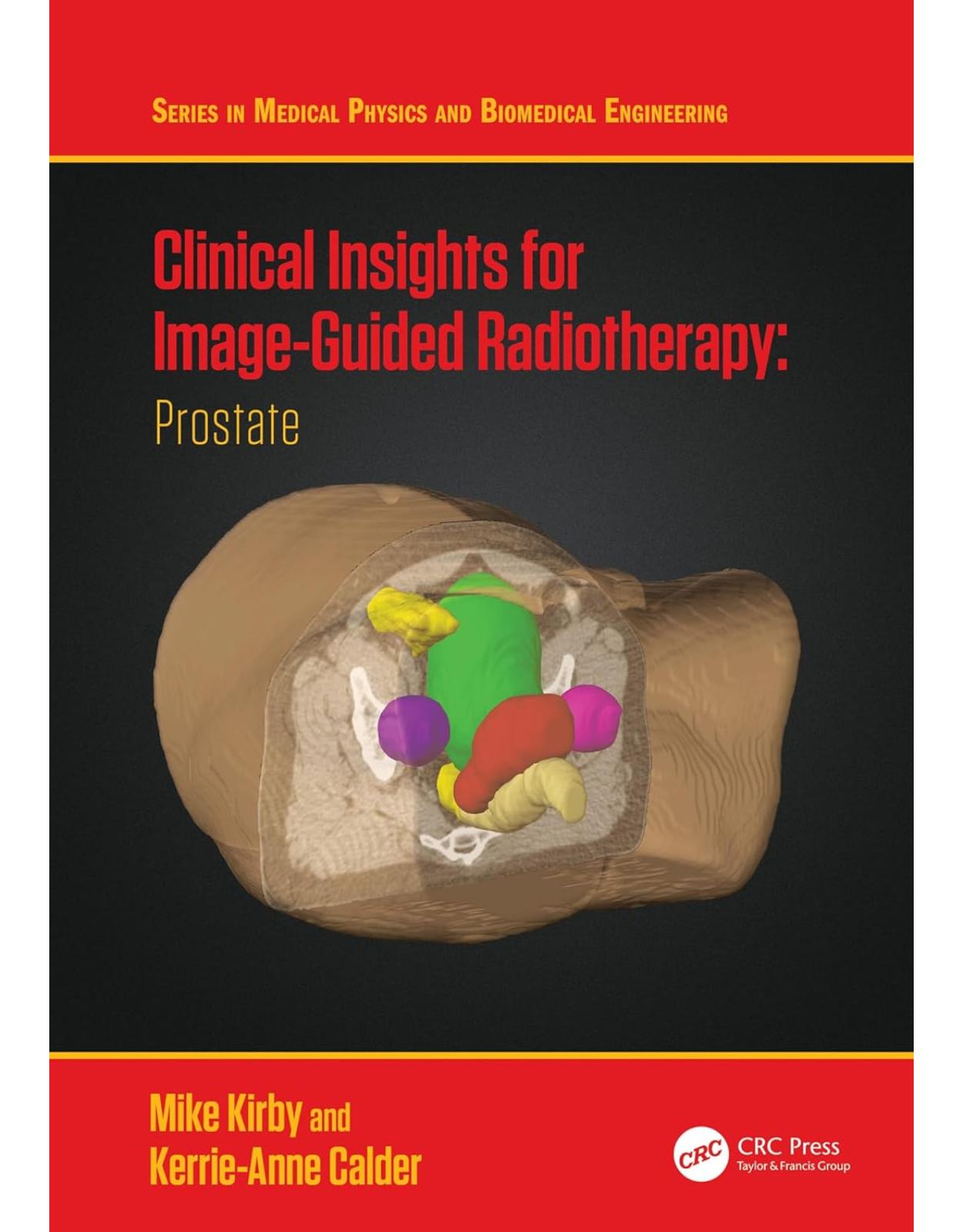Clinical Insights for Image-Guided Radiotherapy: Prostate