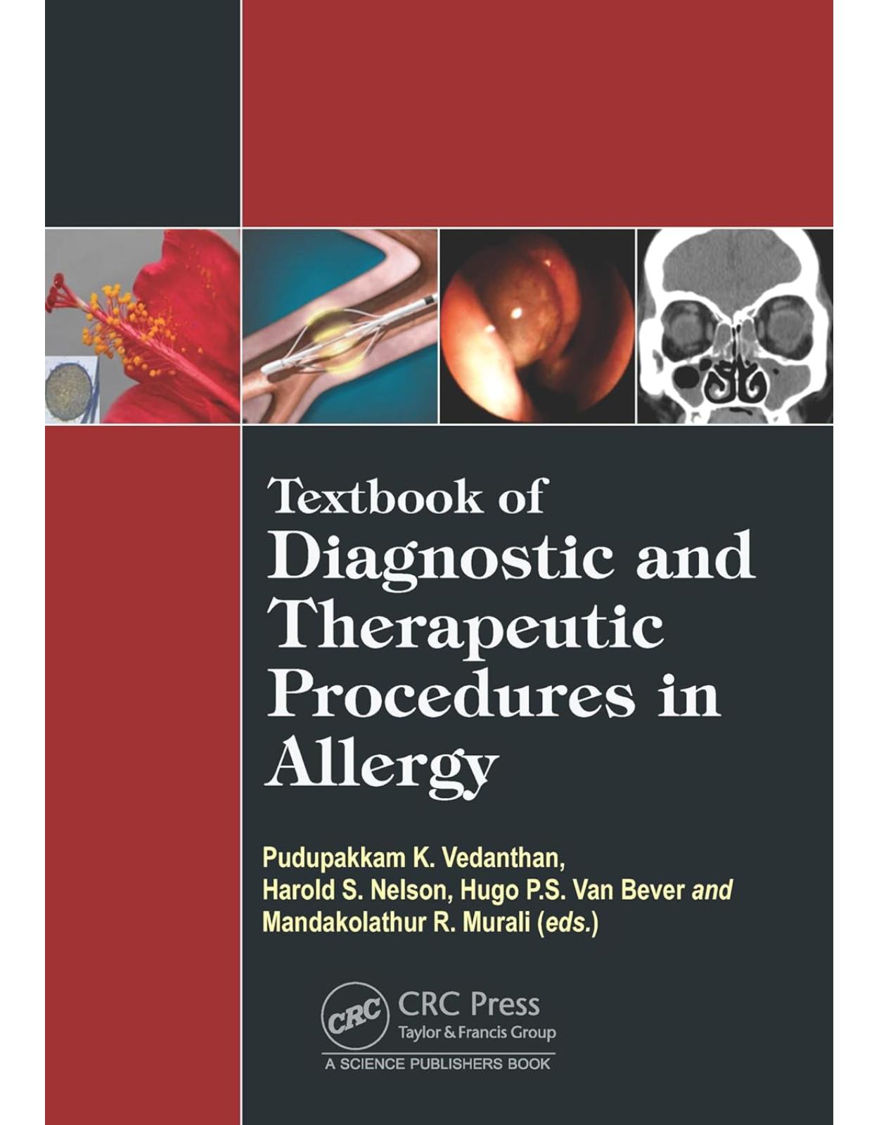 Textbook of Diagnostic and Therapeutic Procedures in Allergy 