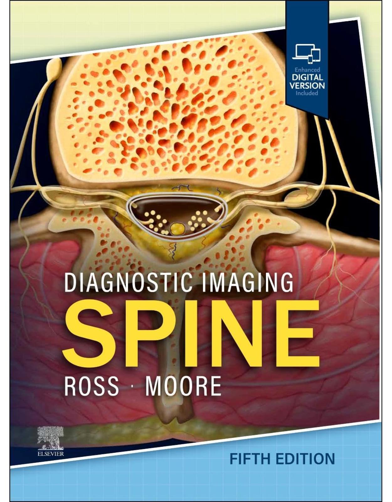 Diagnostic Imaging: Spine 5th Edition