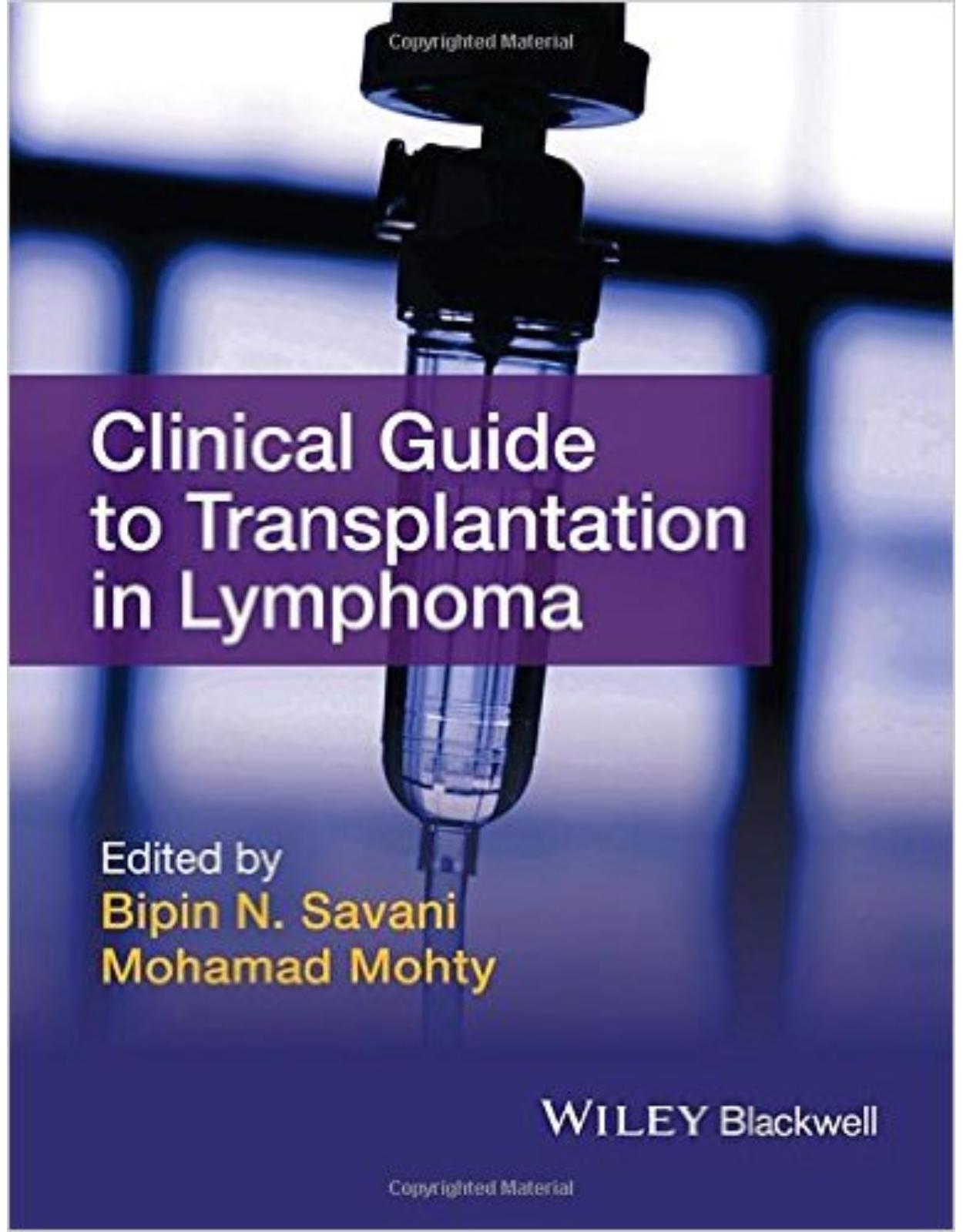 Clinical Guide to Transplantation in Lymphoma