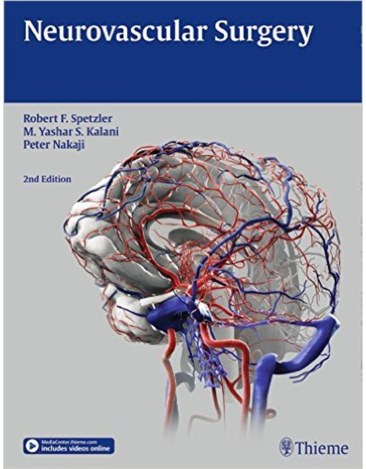 Neurovascular Surgery 2nd Edition Edition