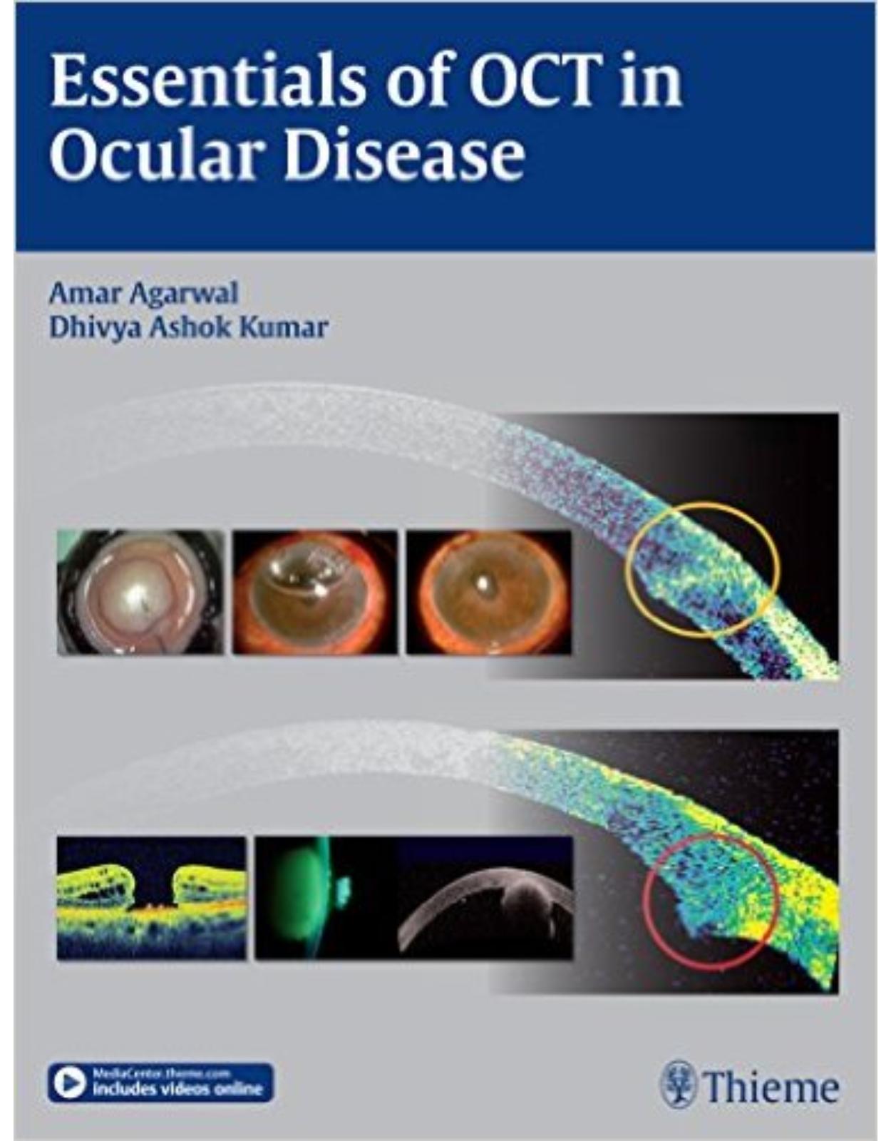 Essentials of OCT in Ocular Disease 1st Edition