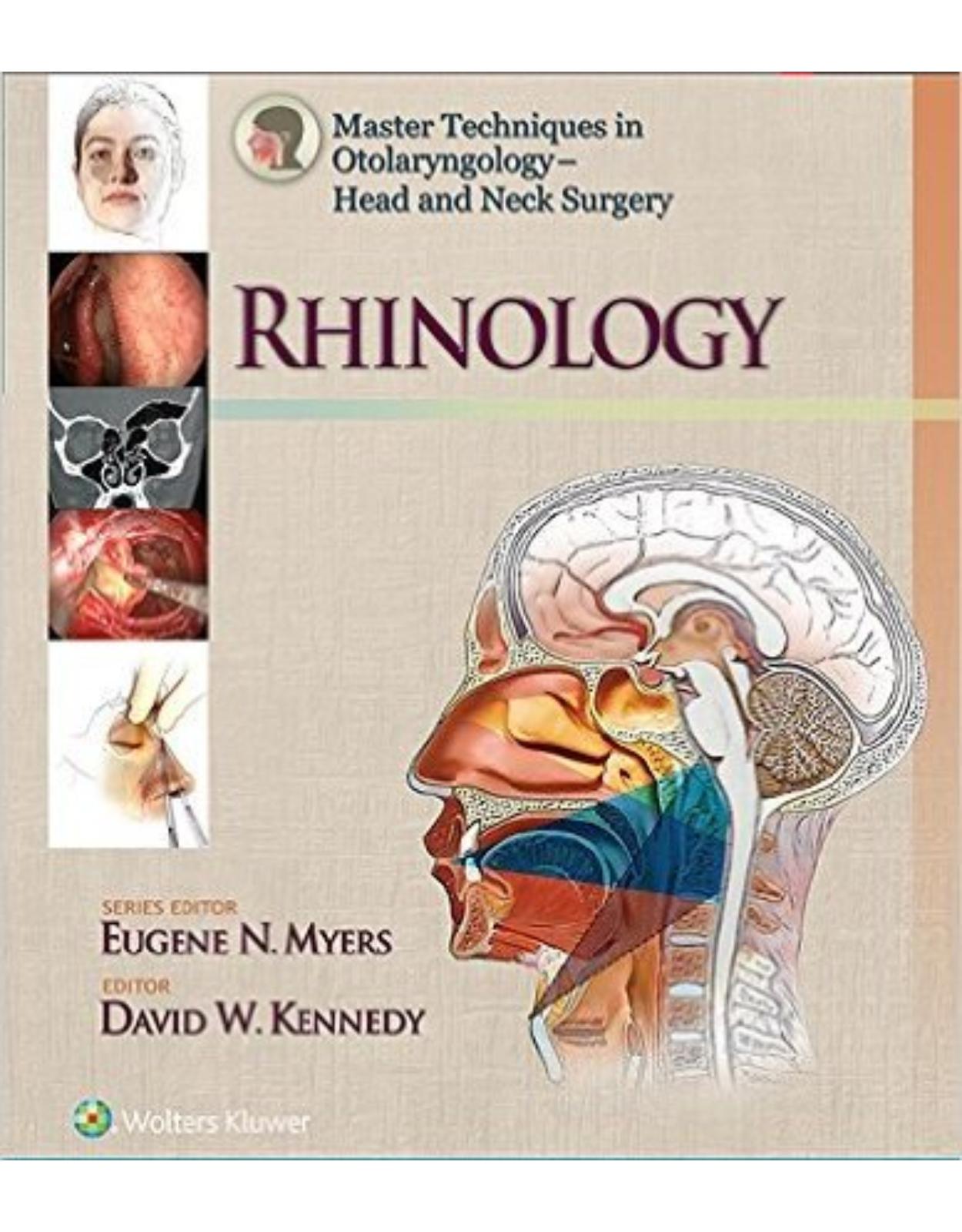 Master Techniques in Otolaryngology - Head and Neck Surgery: Rhinology (Master Techniques in Otolaryngology Surgery) First Edition